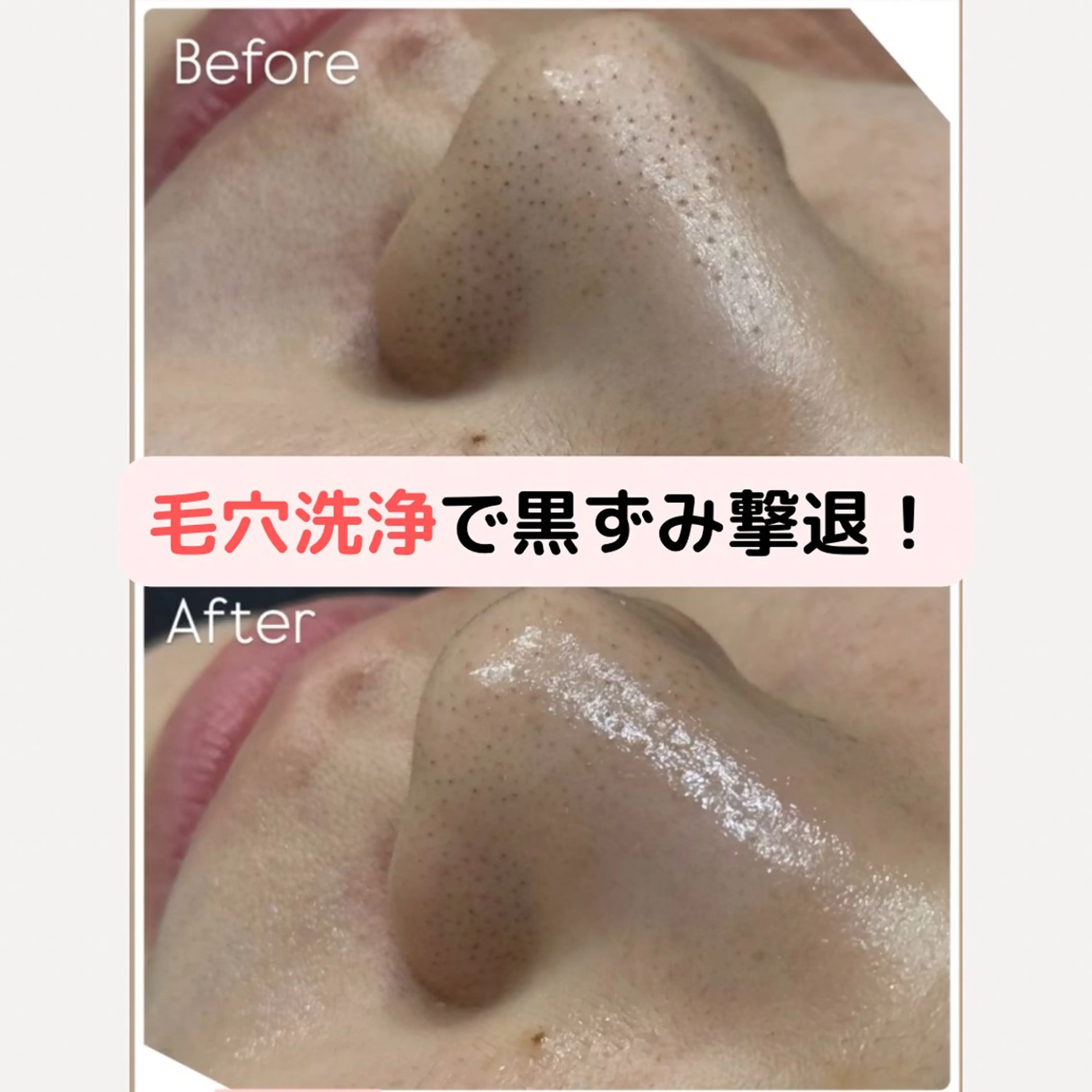 エステ 美肌脱毛サロン muroのエステ・リラクイメージ