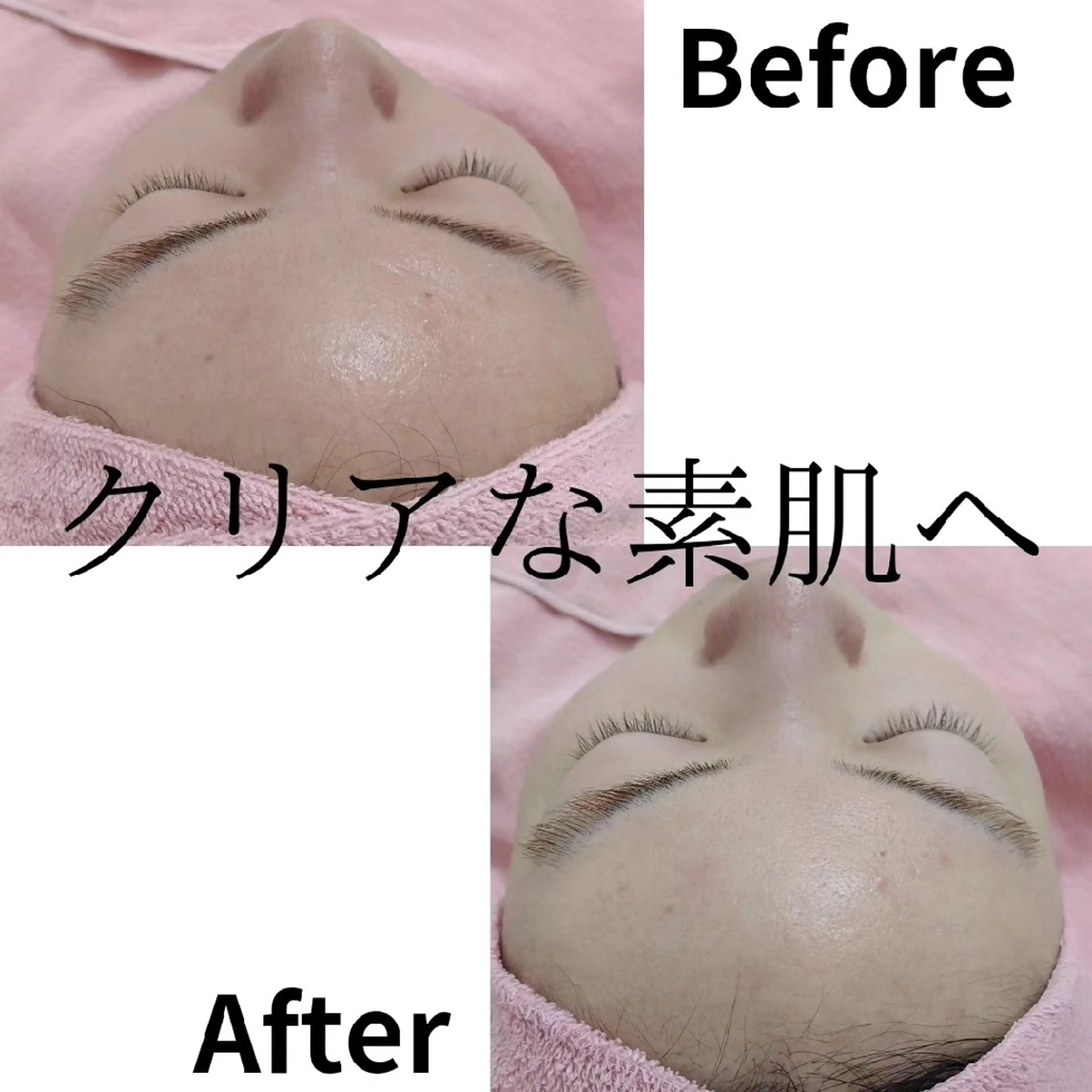 メンズ エステ ユニセックスエステサロンUniclear所属・佐賀痩身エステ/小顔 @uni.clearのエステ・リラクイメージ