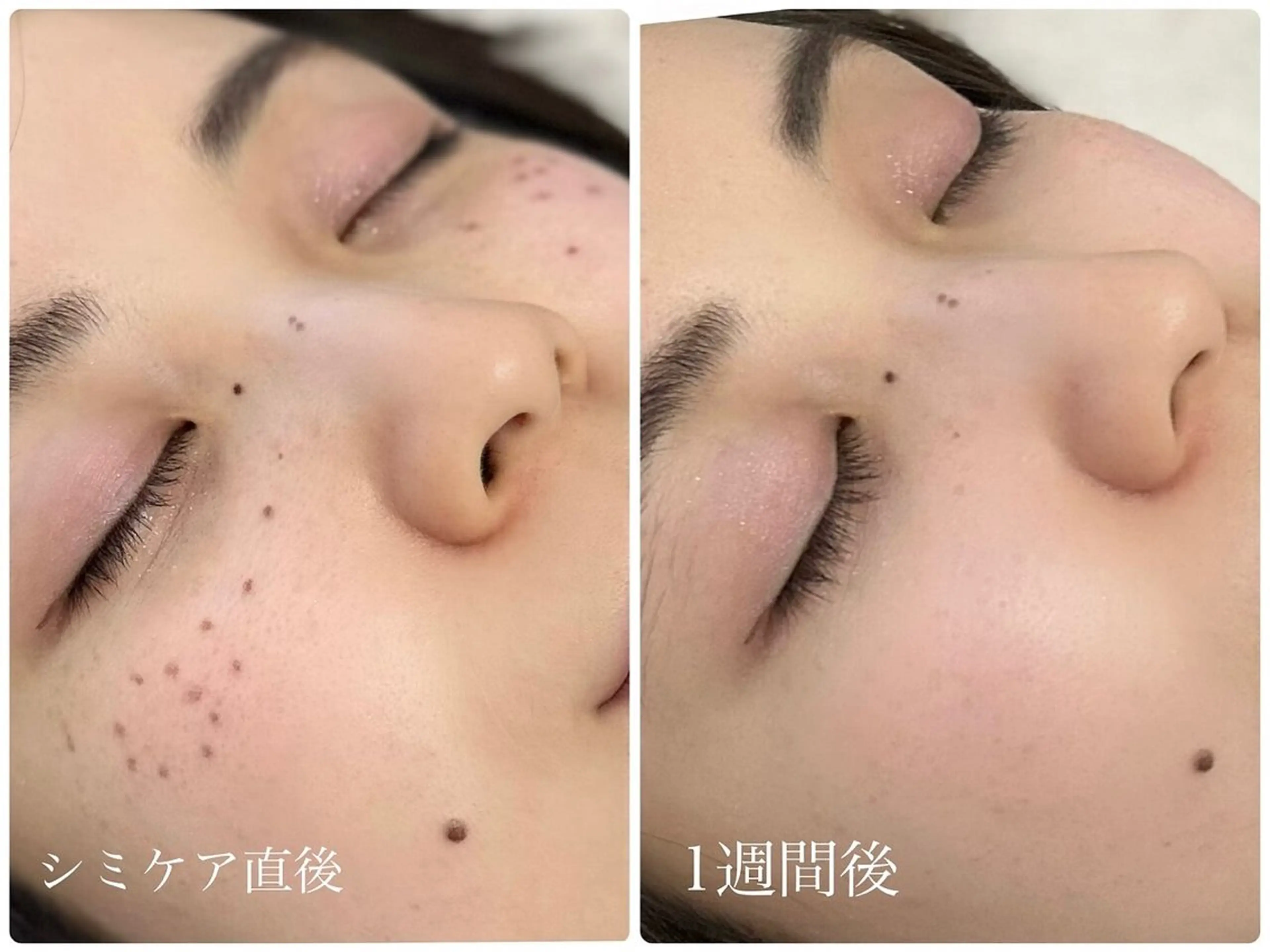 素肌をキレイに ラウレア🌼Hayaのエステ・リラクイメージ