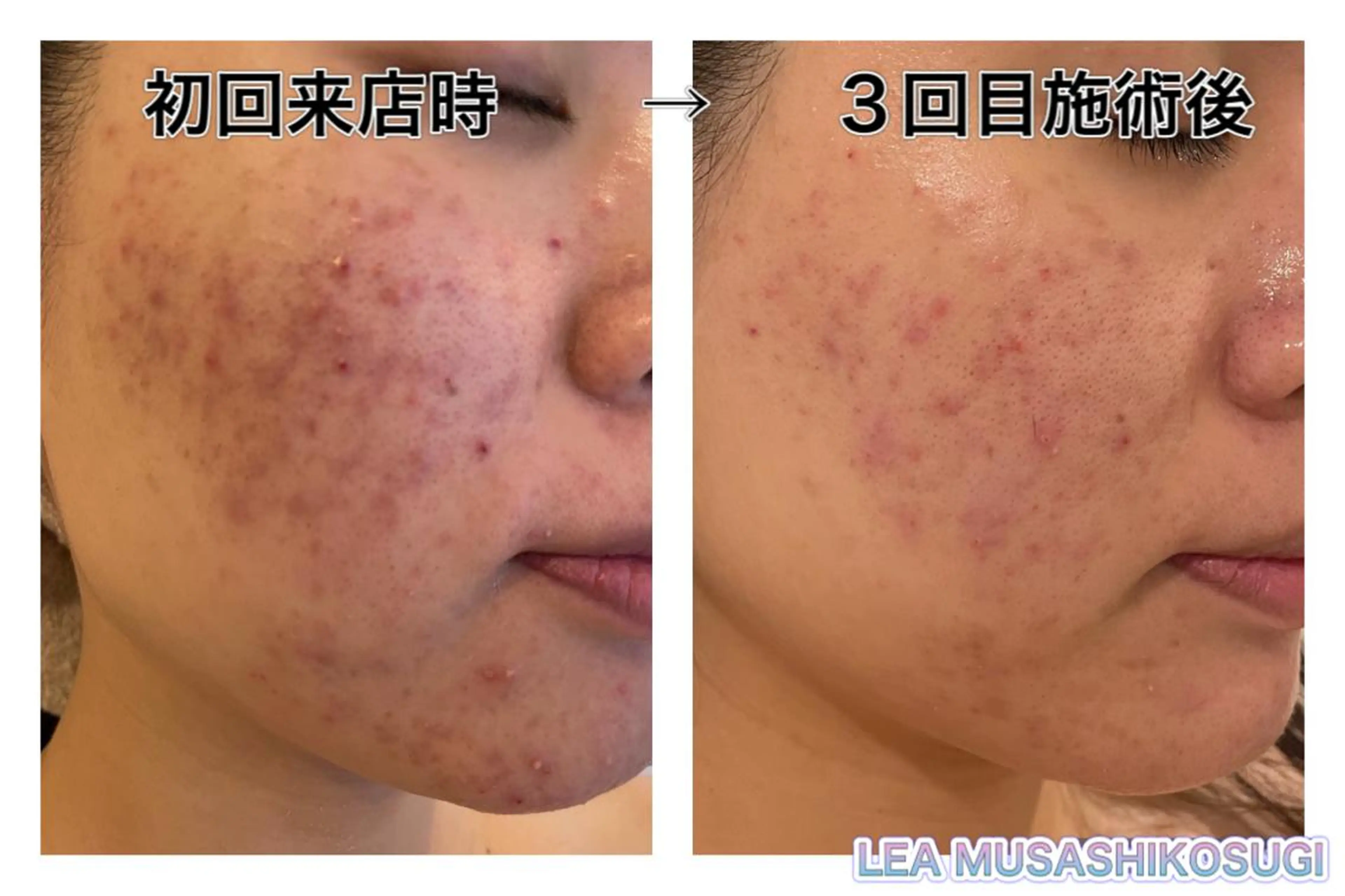 美肌育成サロン LEA武蔵小杉のエステ・リラクイメージ