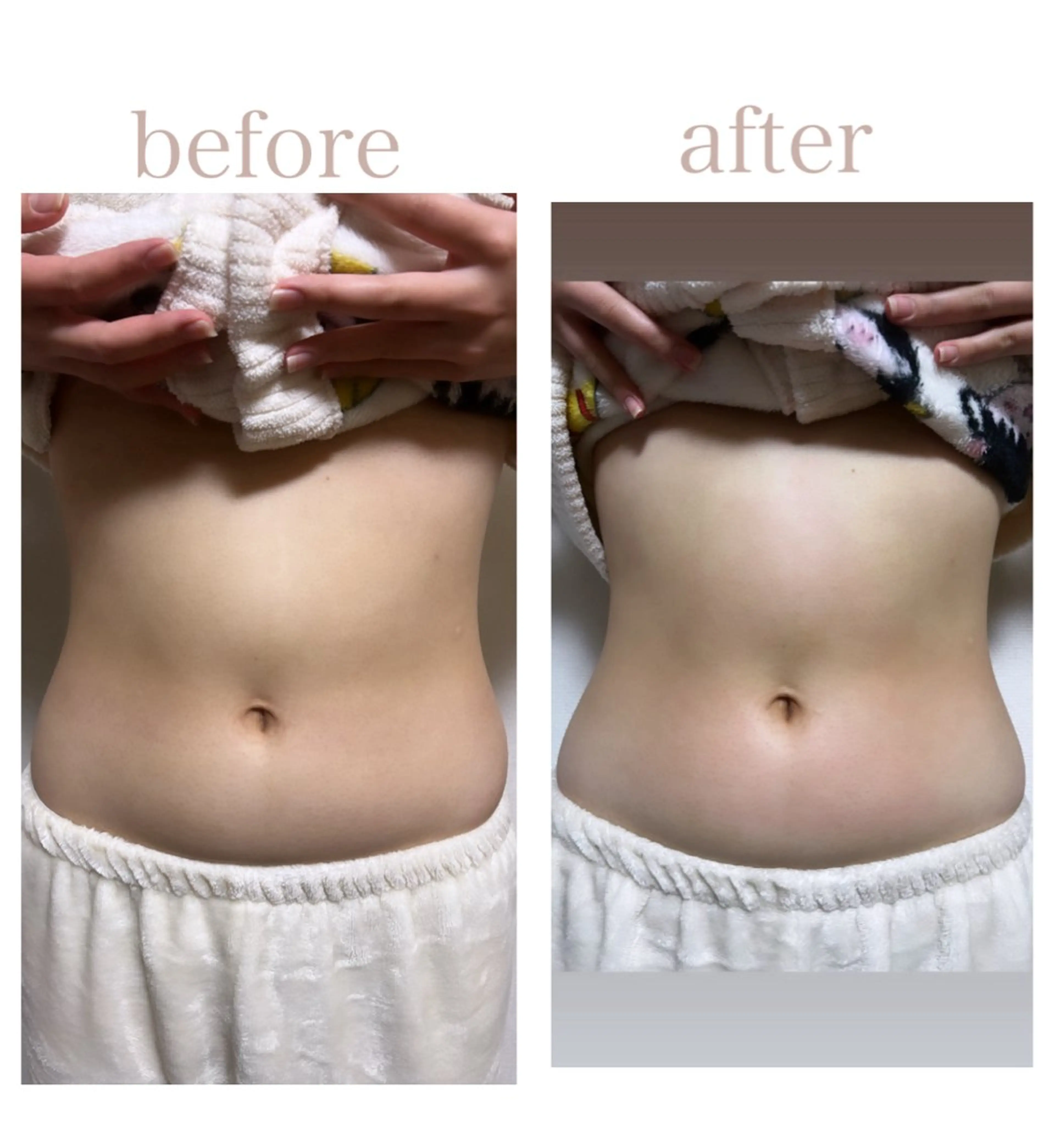 エステ Chii Salon ネイル/痩身エステのネイルデザイン