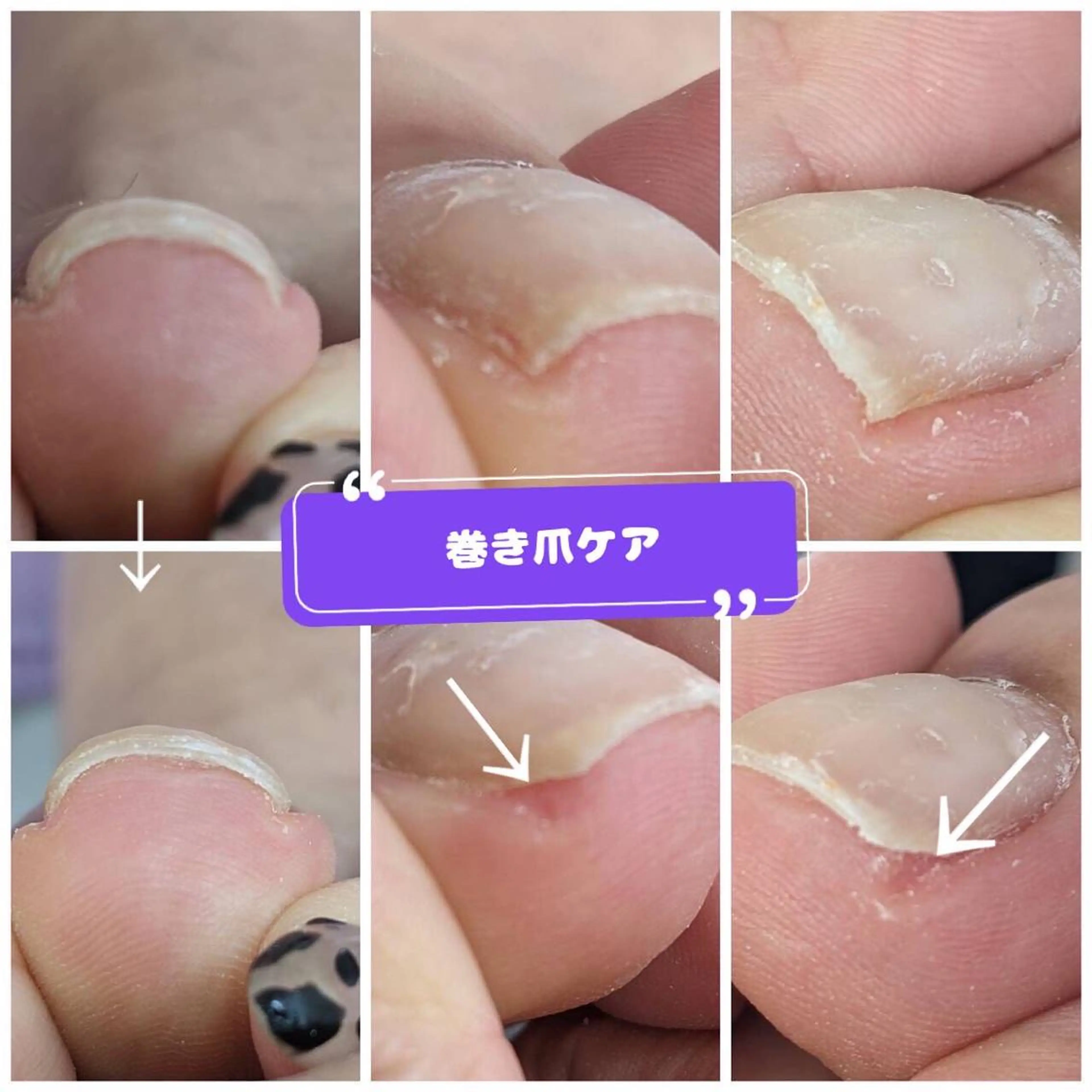 ネイル 和賀井 恵理のネイルデザイン