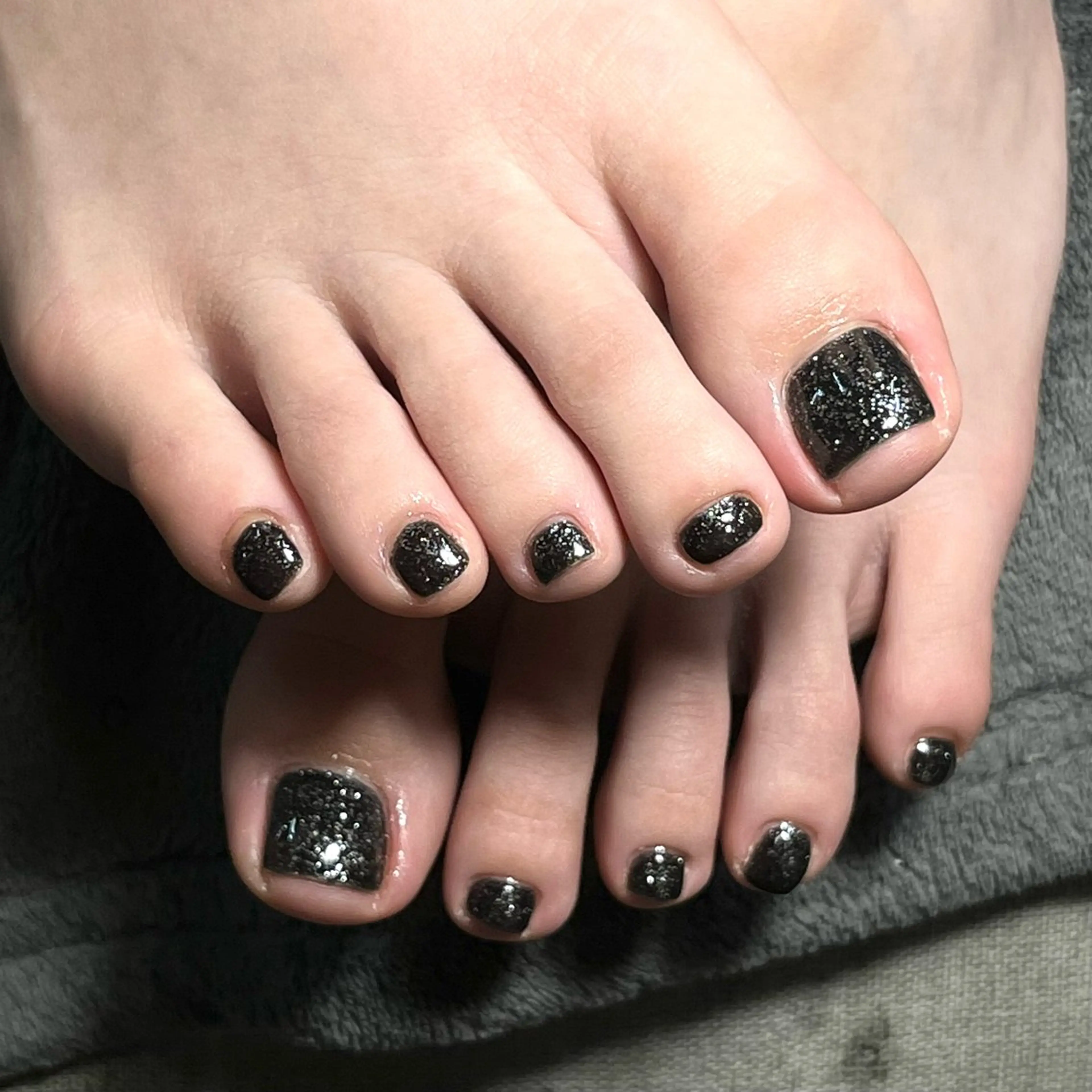 👣フット巻き爪矯正+シェラックルクス👣オフあり⭕️の写真