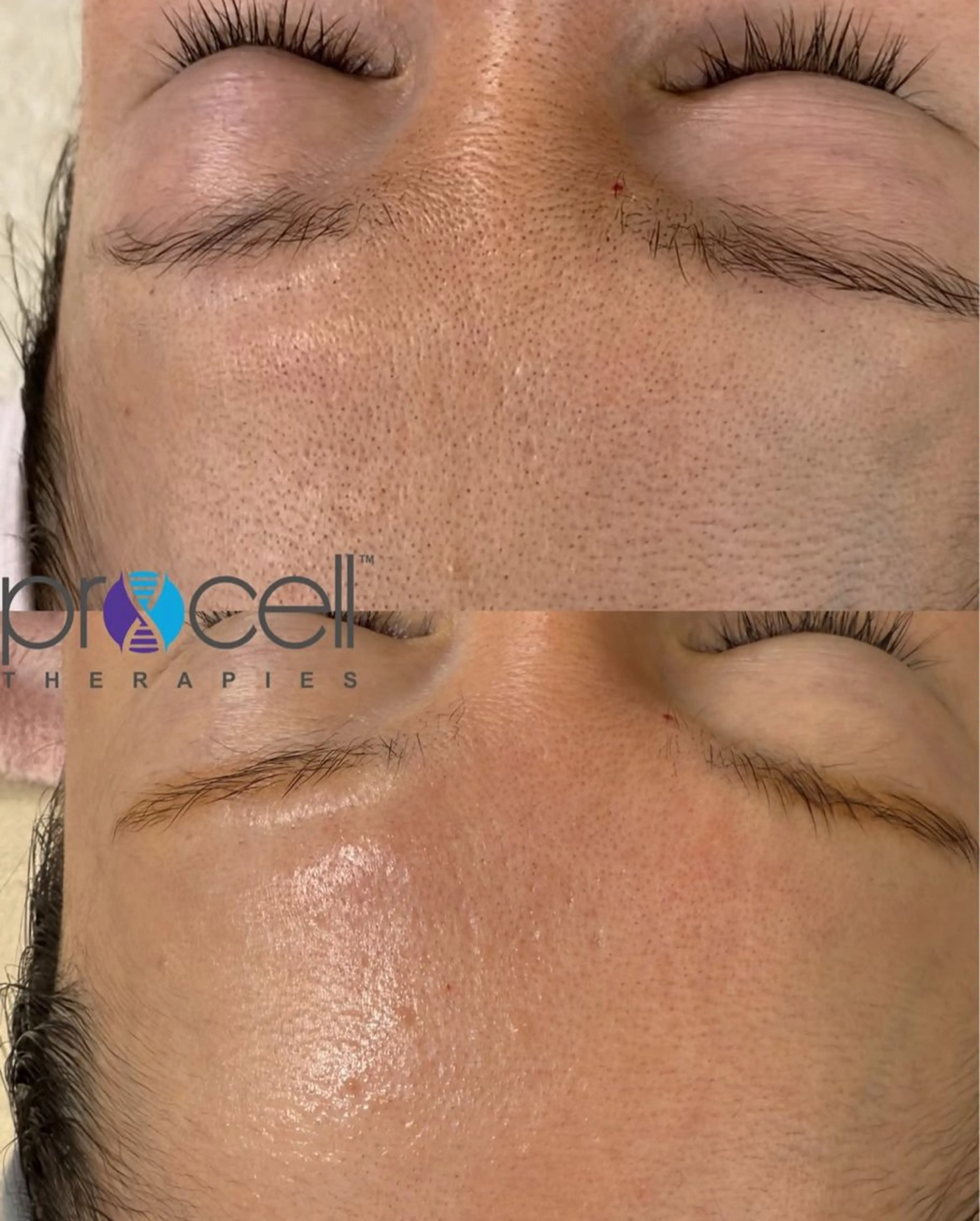 LOUISE. ／肌質・頭皮のエステ・リラクイメージ