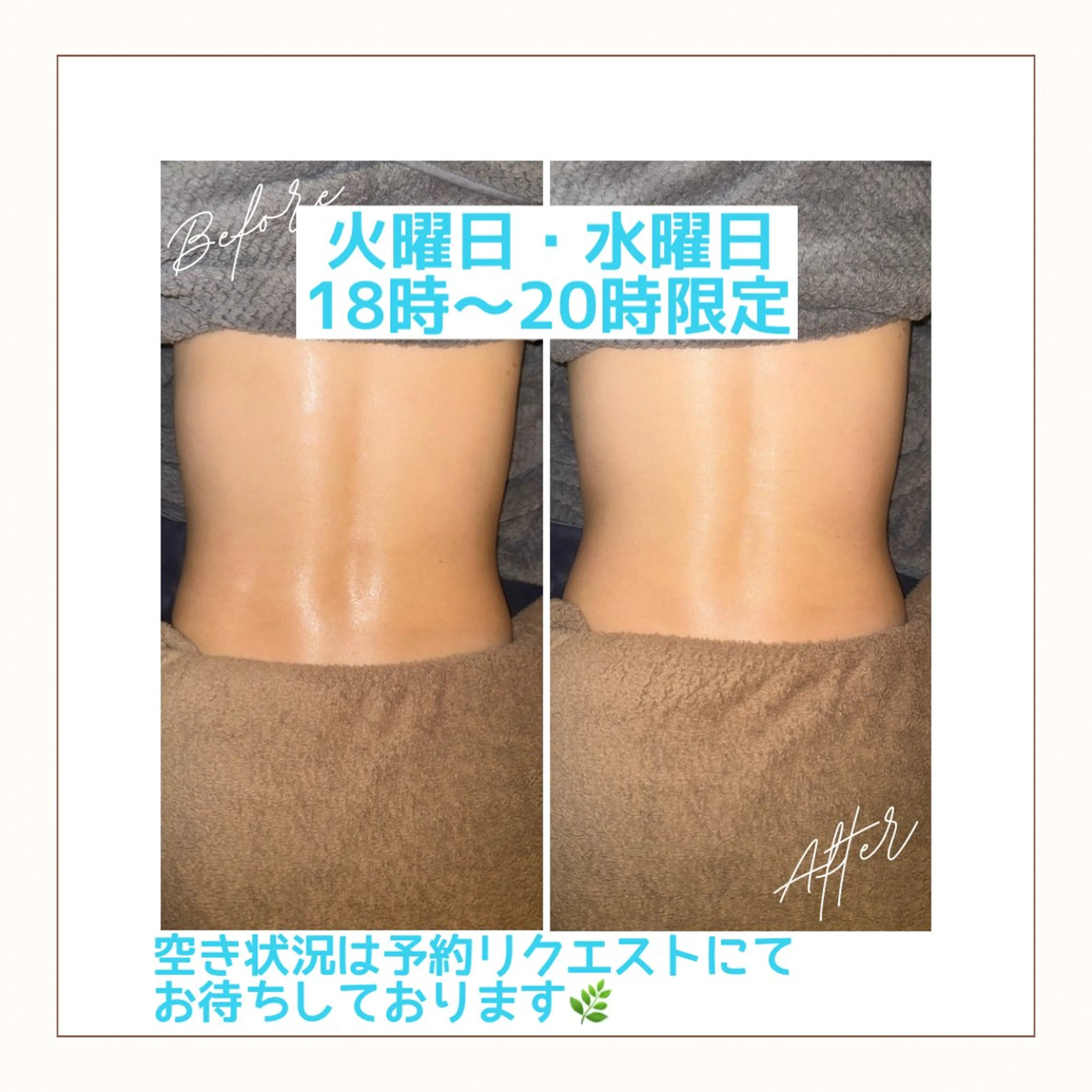 【上半身痩身ケア】初回お試し価格‼️の写真