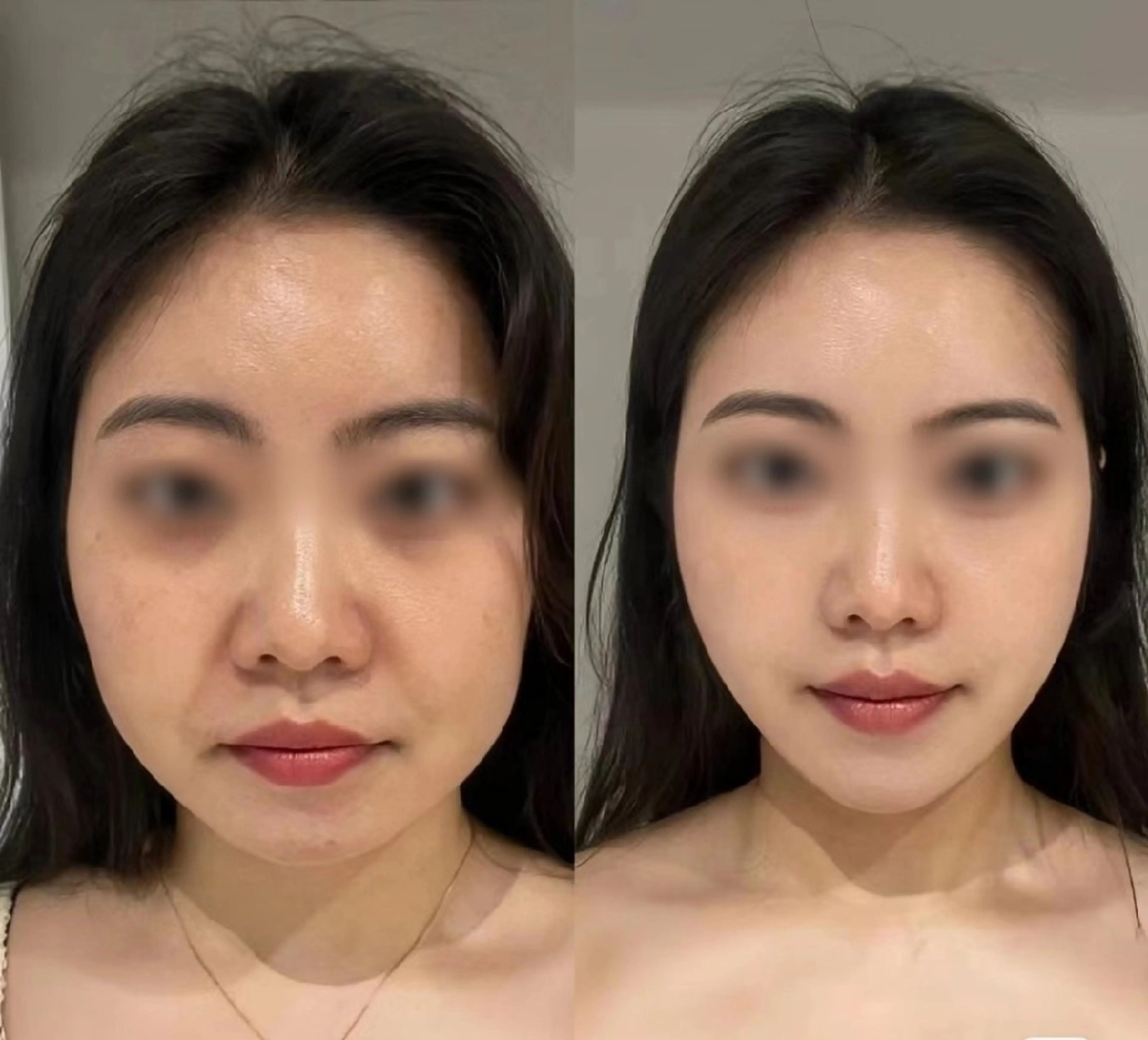 マツエク・マツパ 結婚式・ブライダル aliaハーブ水光店 エステティシャン募集のエステ・リラクイメージ