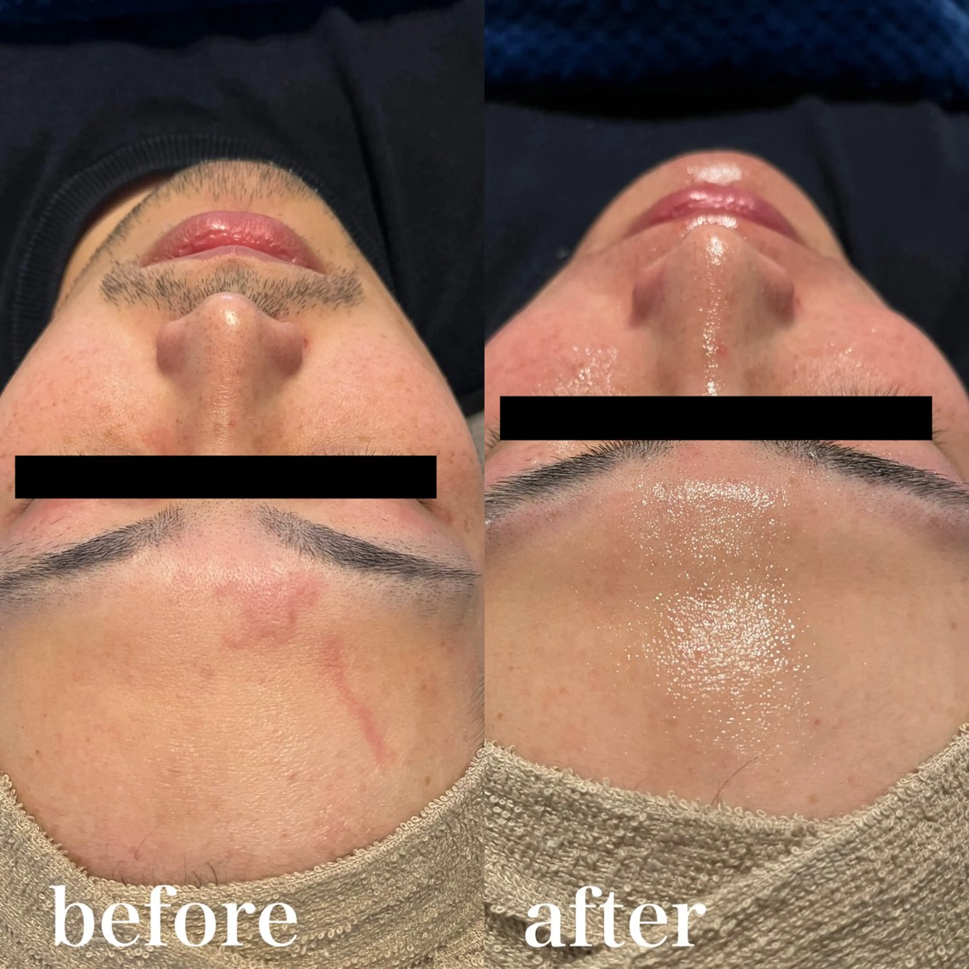 メンズ 脱毛 wax脱毛専門店 ハイラントのエステ・リラクイメージ