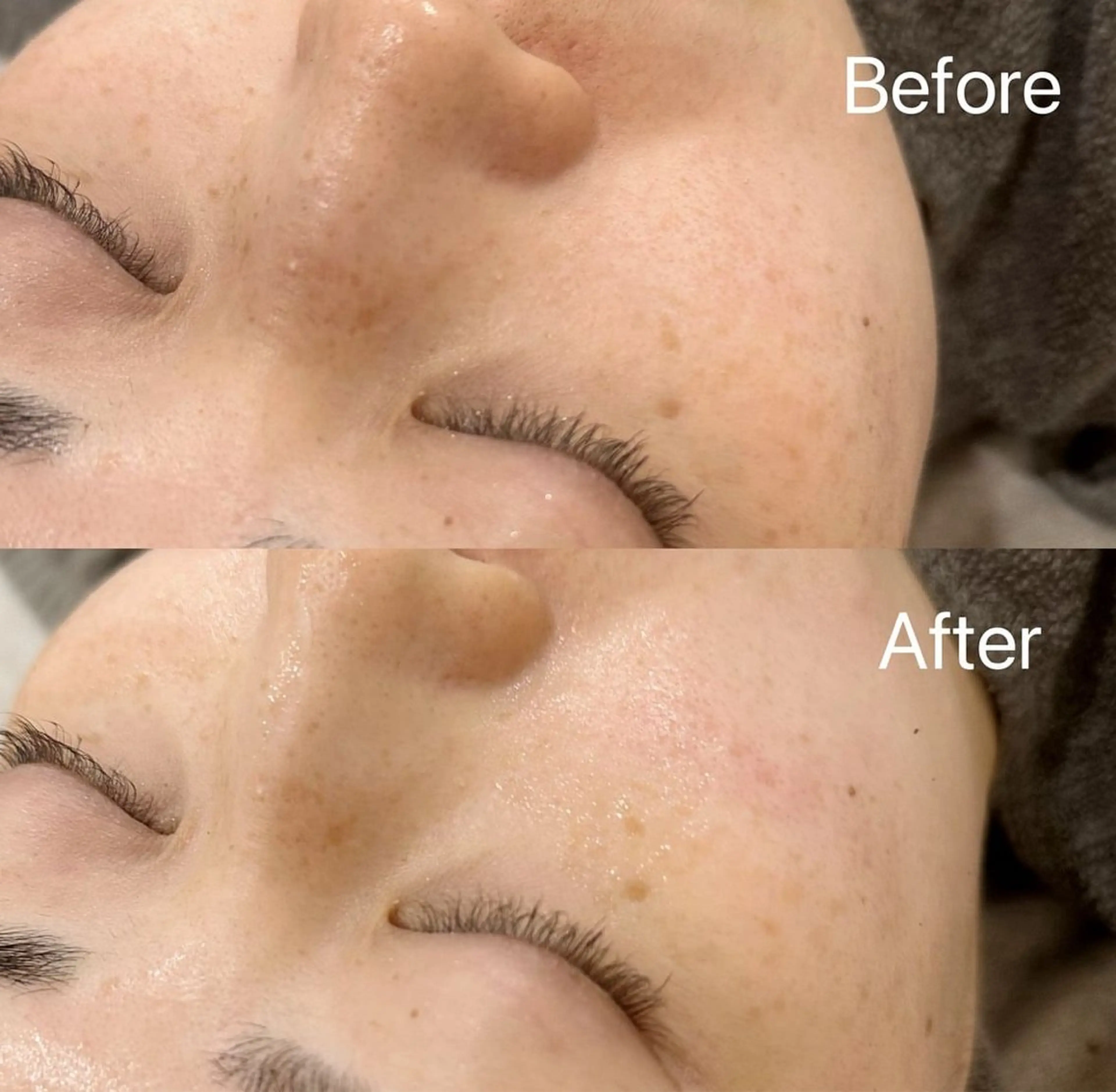 エステ 【foi】 natsumi🌼のその他イメージ