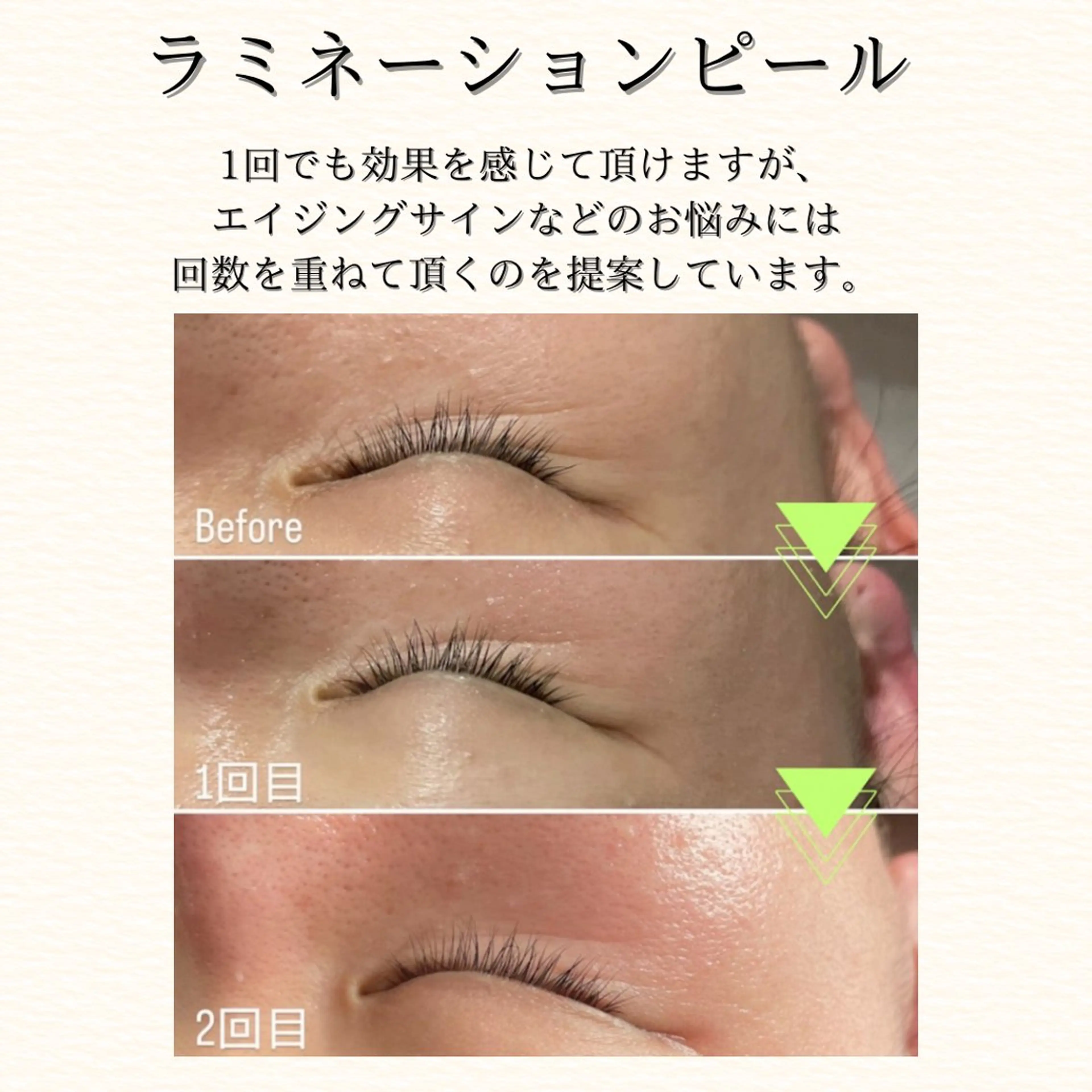 hue. YUKAのエステ・リラクイメージ