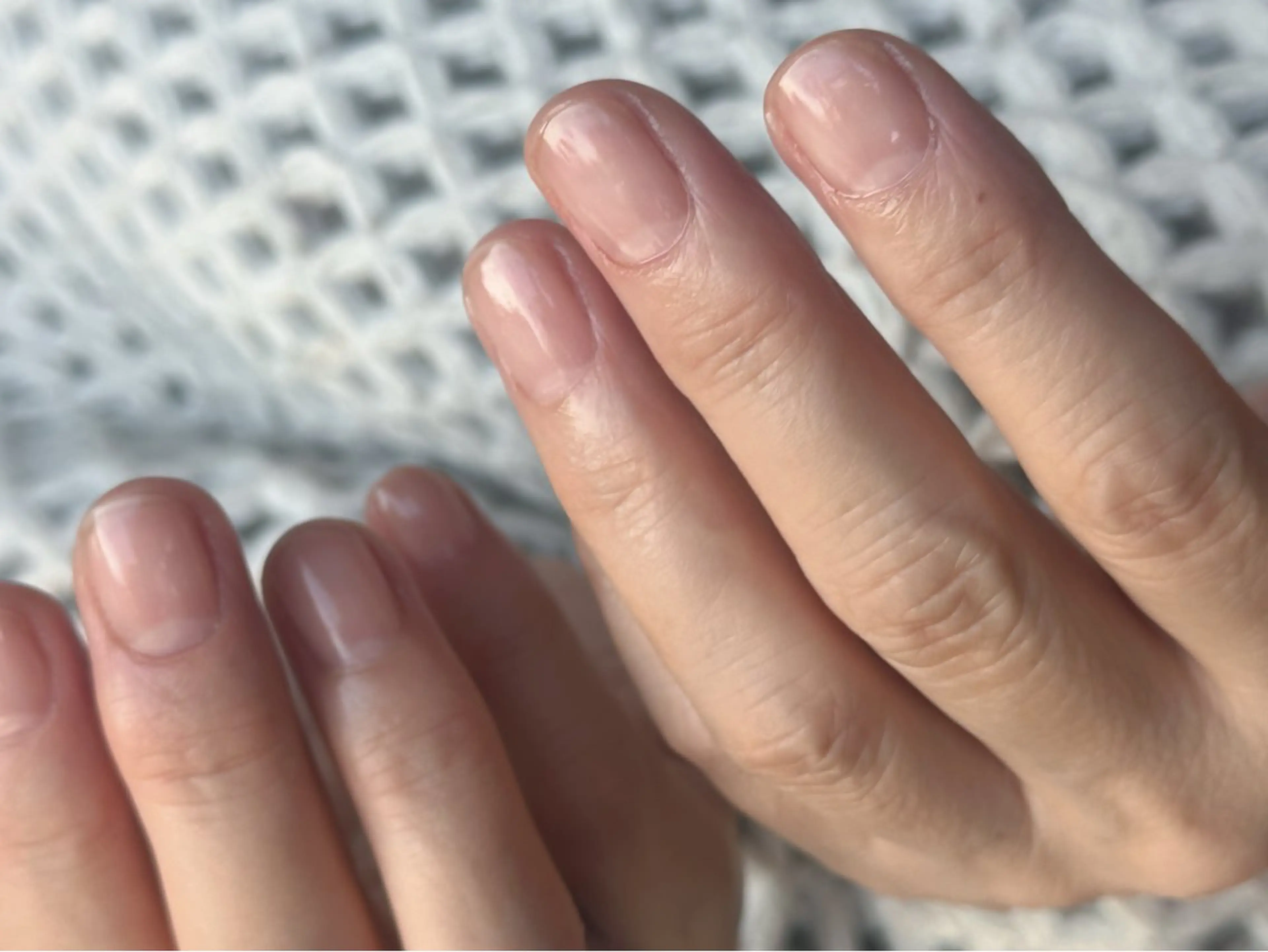 ネイル fote-自爪育成 ネイルケアサロン-のネイルデザイン