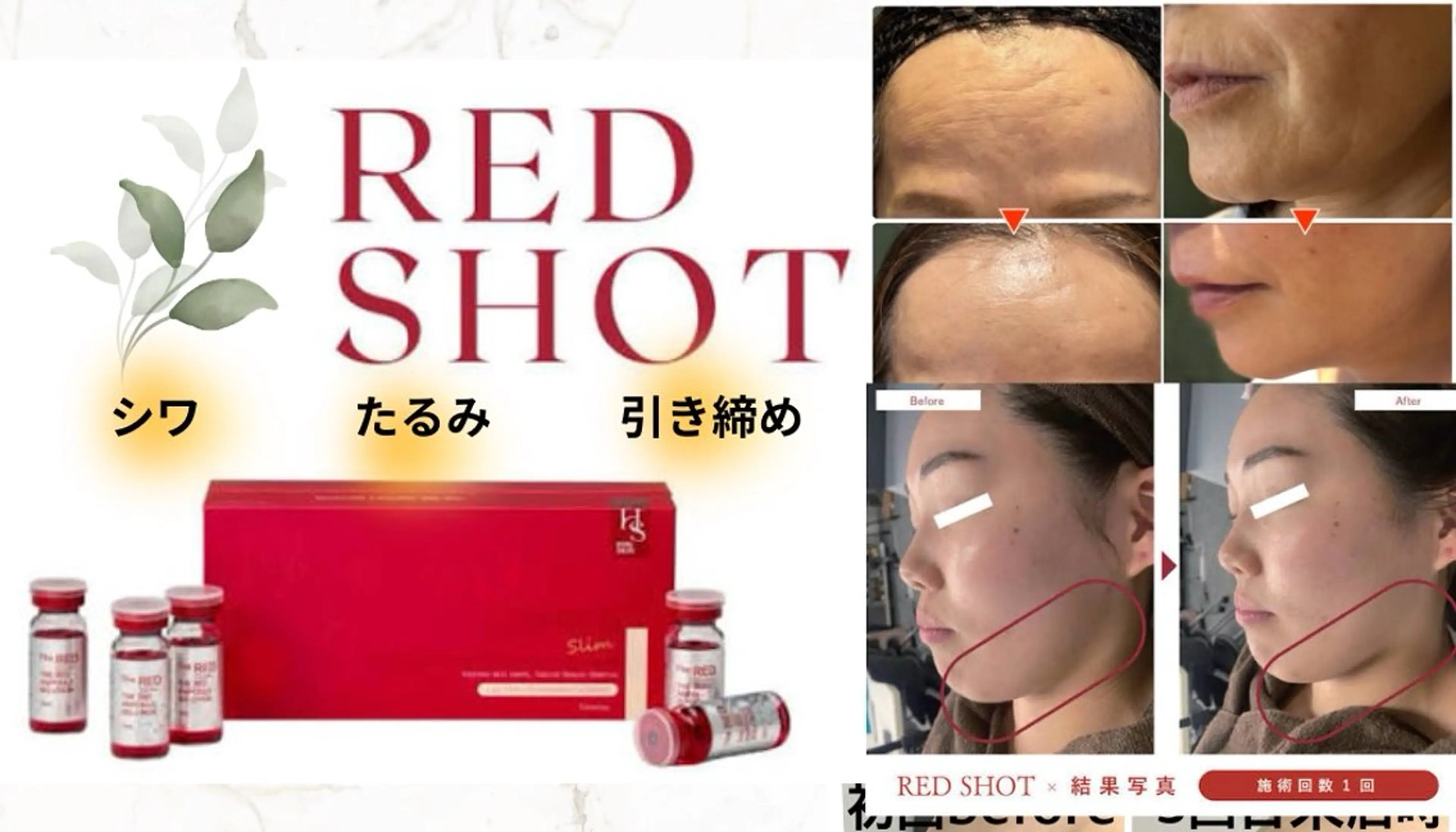 【シワ・たるみ】レッドショットで引き締めフェイシャル♪の写真