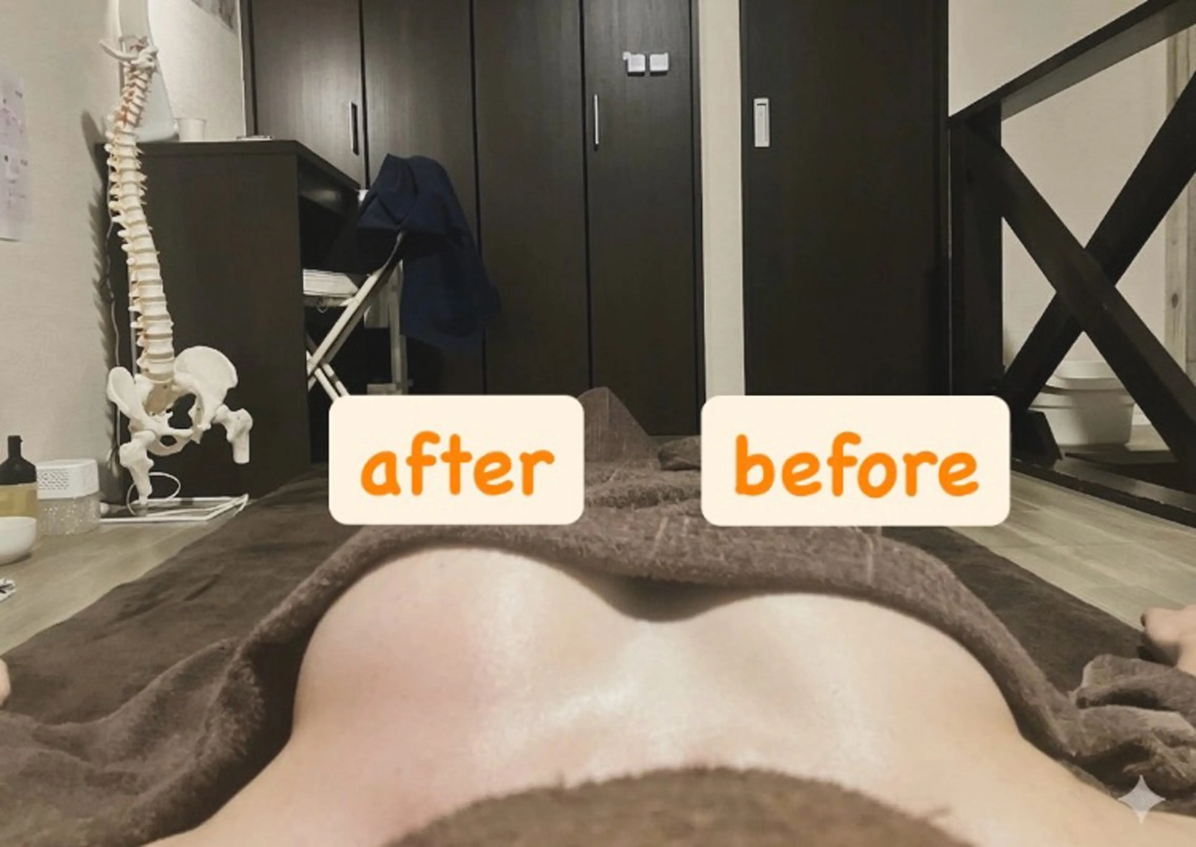 《バストアップ》形・位置・ハリをだす！左右非対称のバストも整える✨の写真