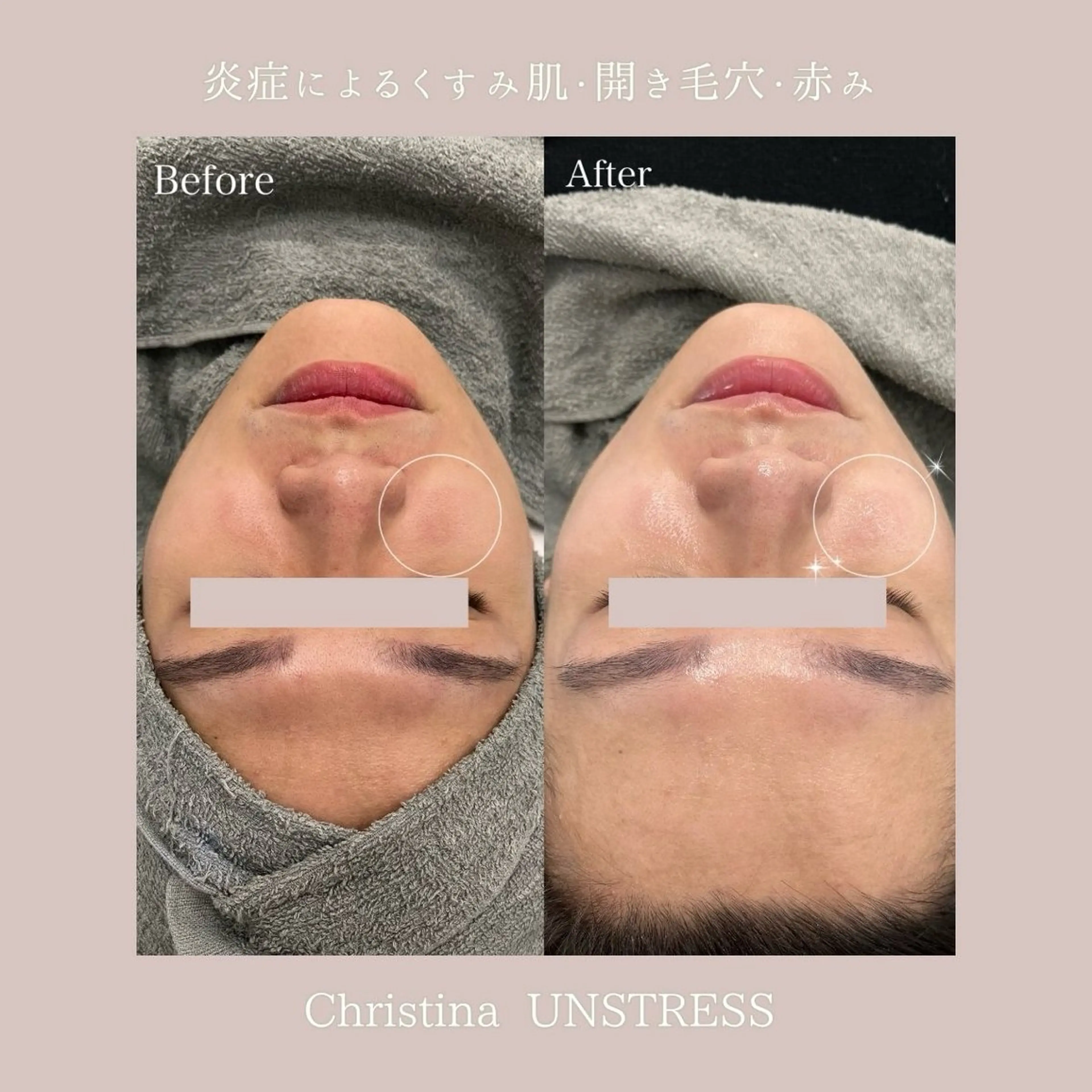 エステ Lyséa新宿 ♡kaoriのエステ・リラクイメージ