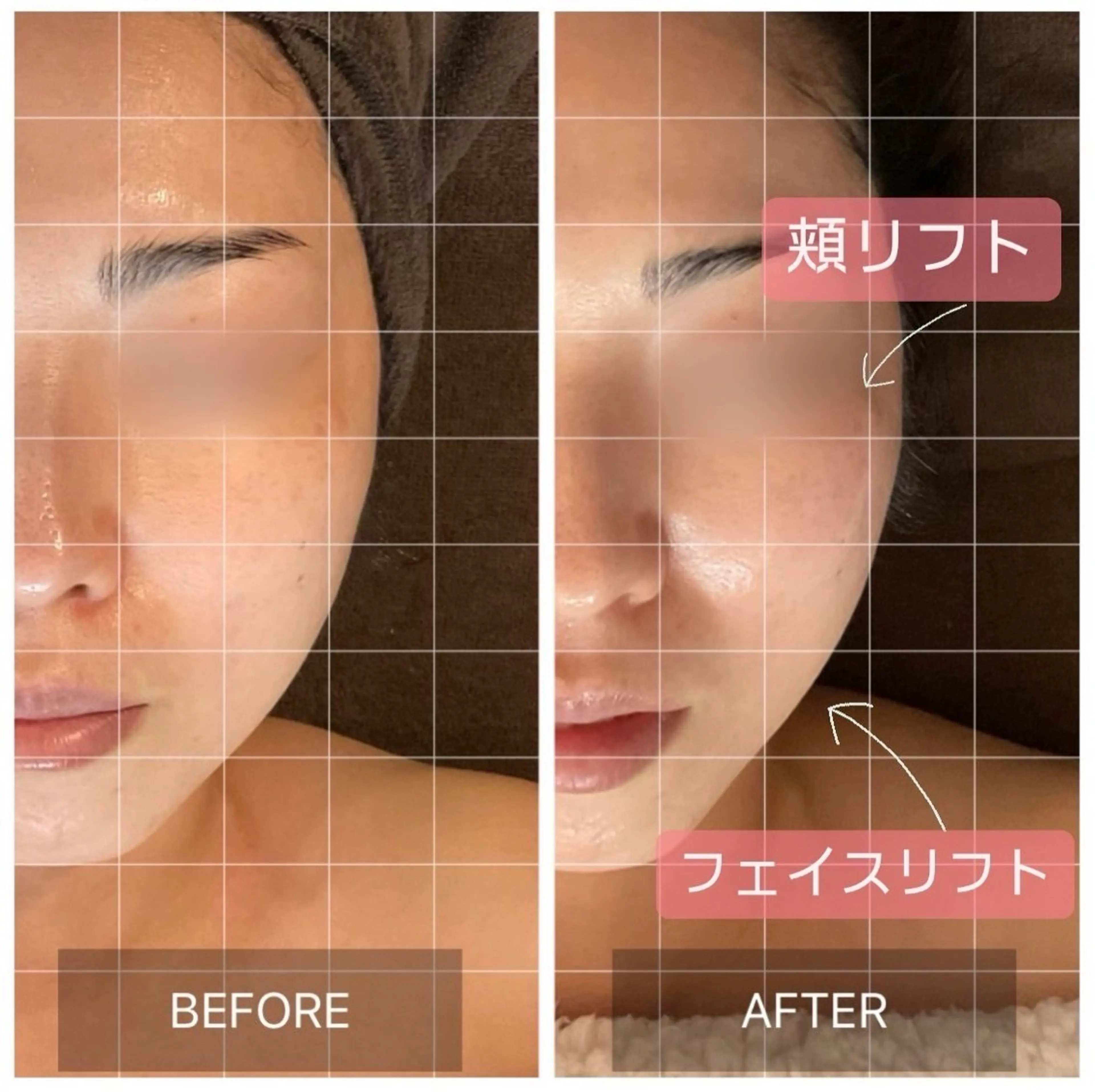 その他 MIRAI小顔 広島駅前店のエステ・リラクイメージ