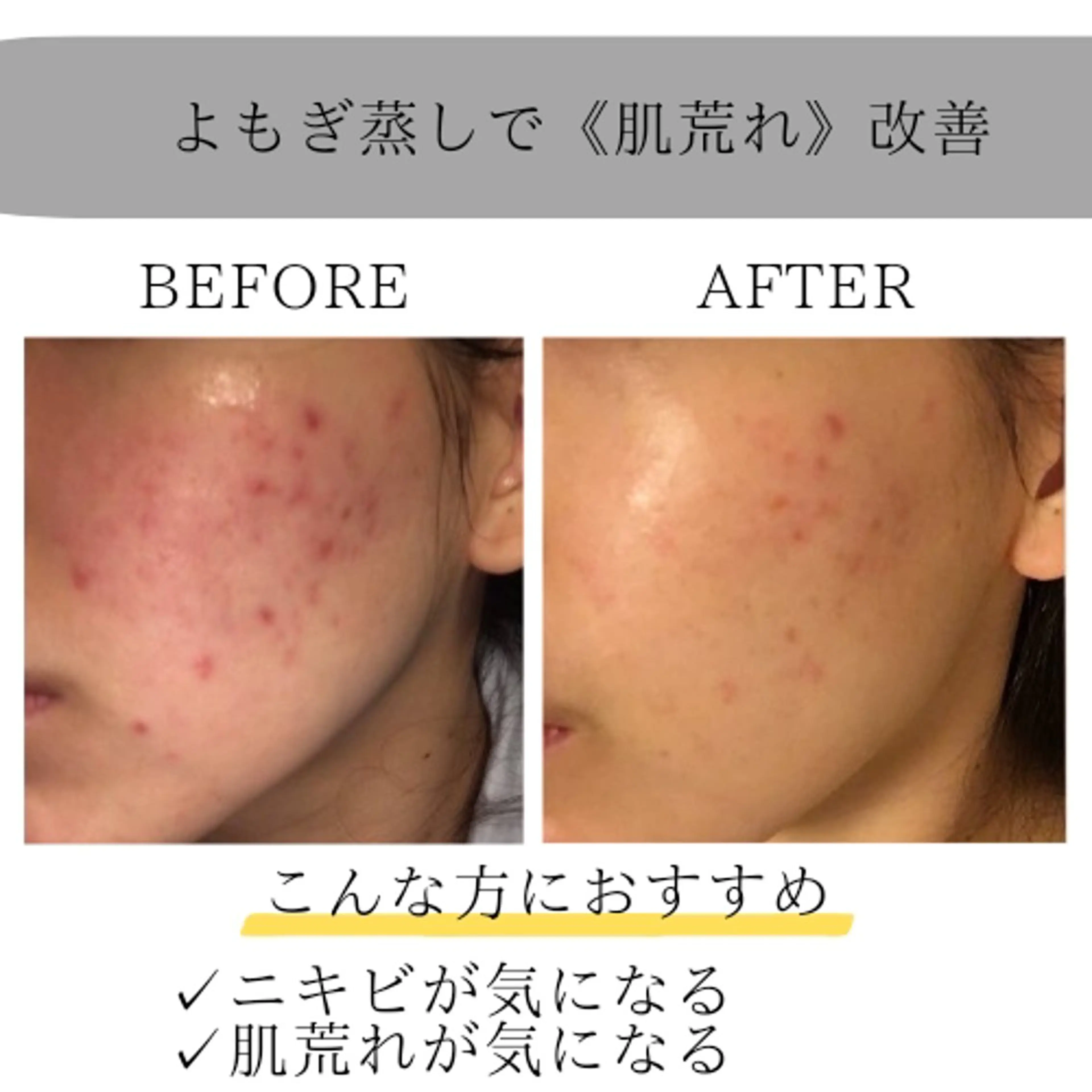 ホワイトニングサロン ネージュ(女性専用)のその他イメージ