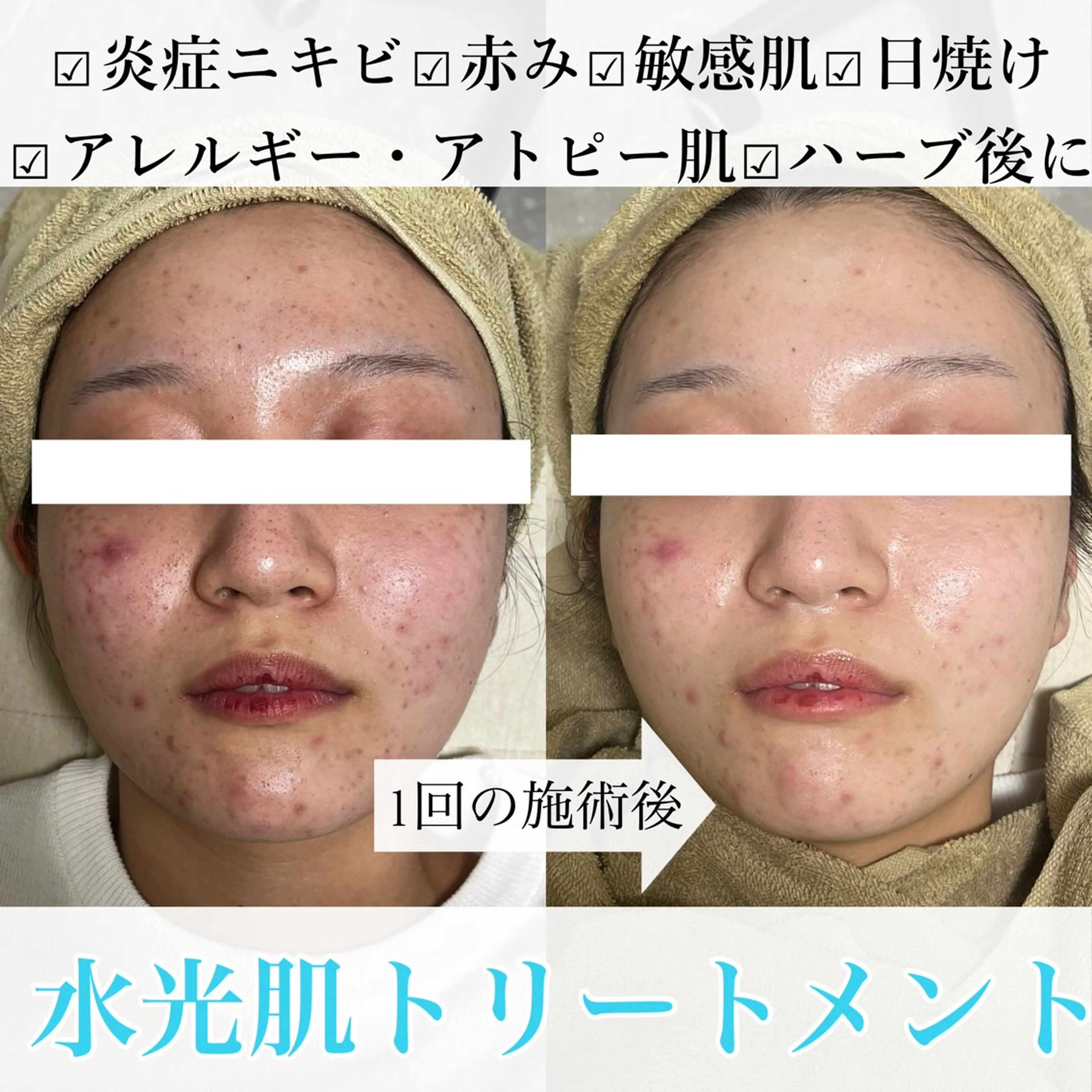 エステ salon ｕｌｕのマツエク・マツパデザイン