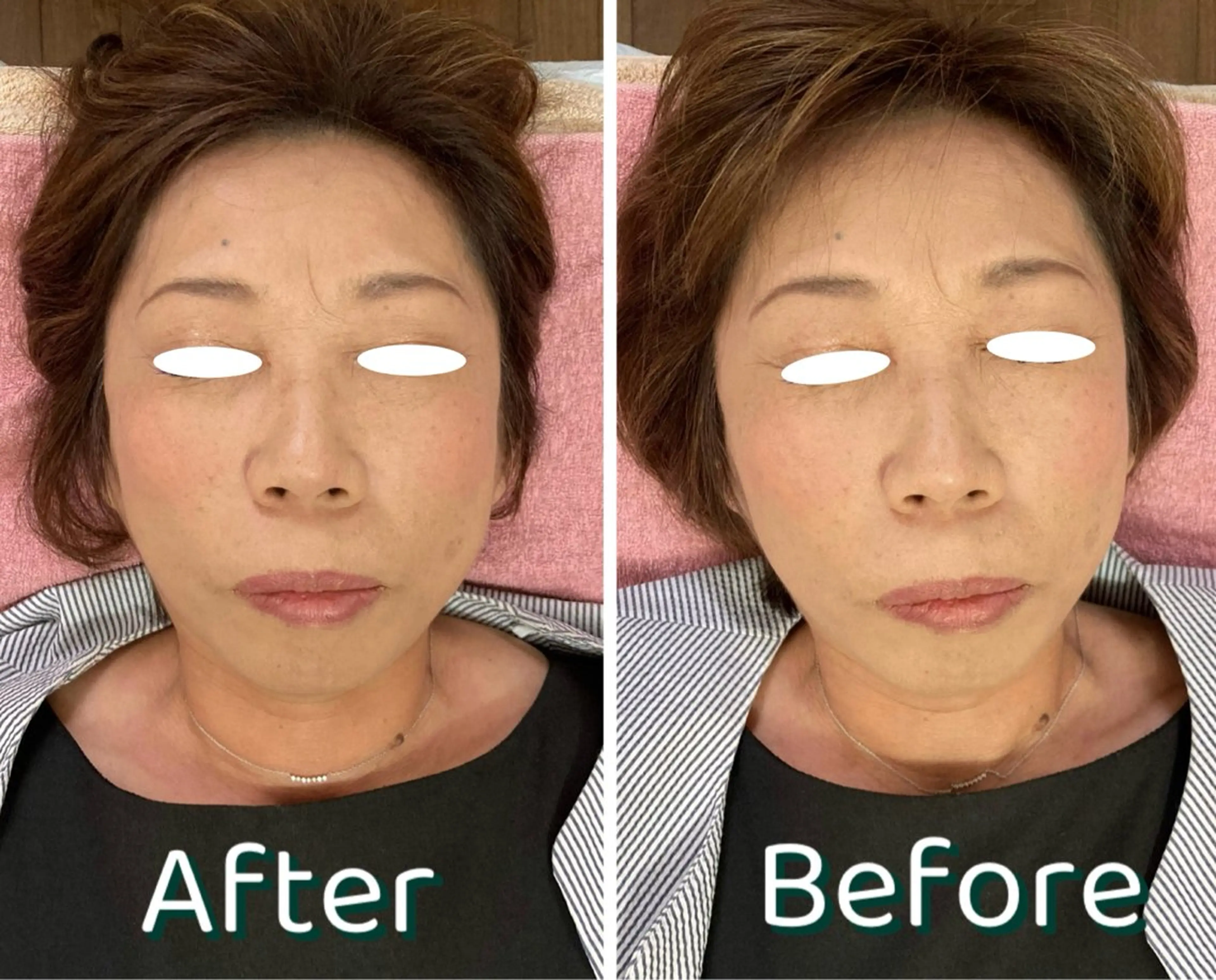 リラク TKサロン所属・TKサロン 柿沼のエステ・リラクイメージ