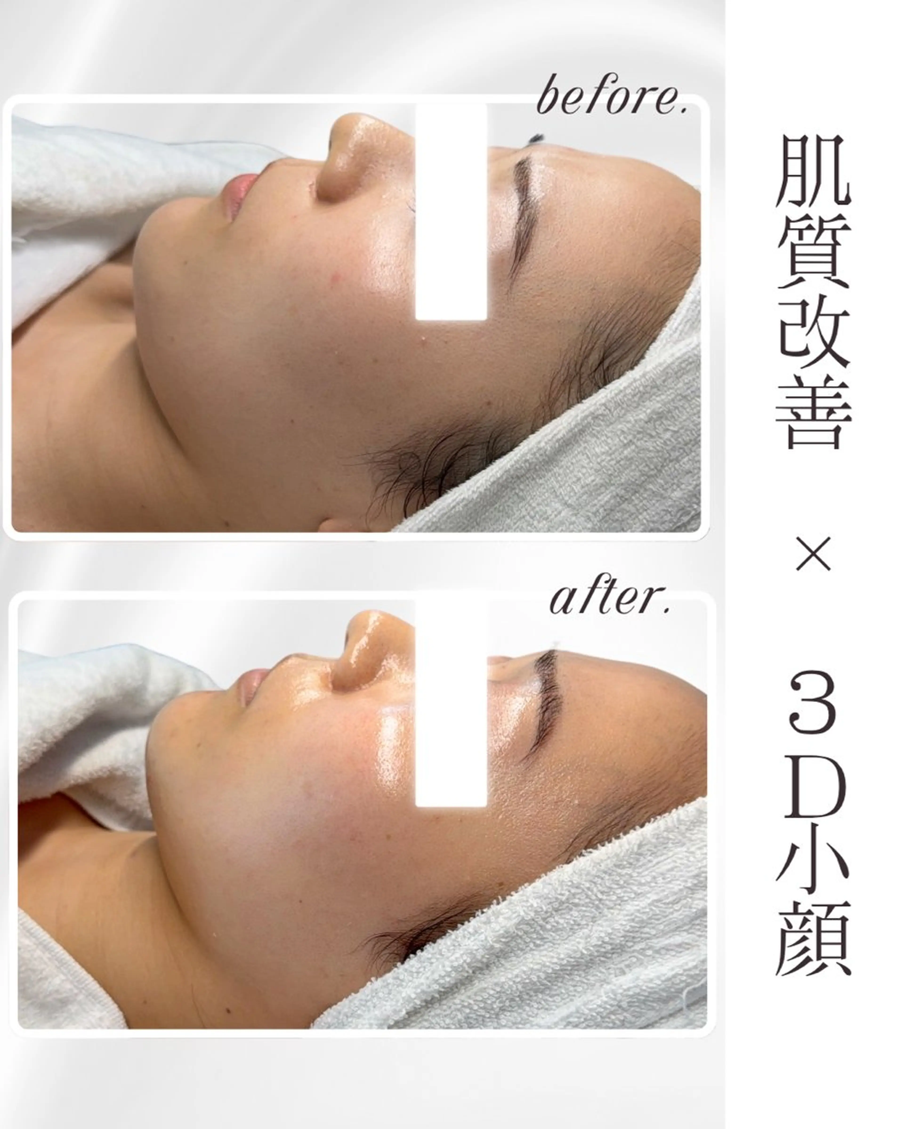 LiAm《美肌管理/ 小顔/脂肪ケア》のその他イメージ