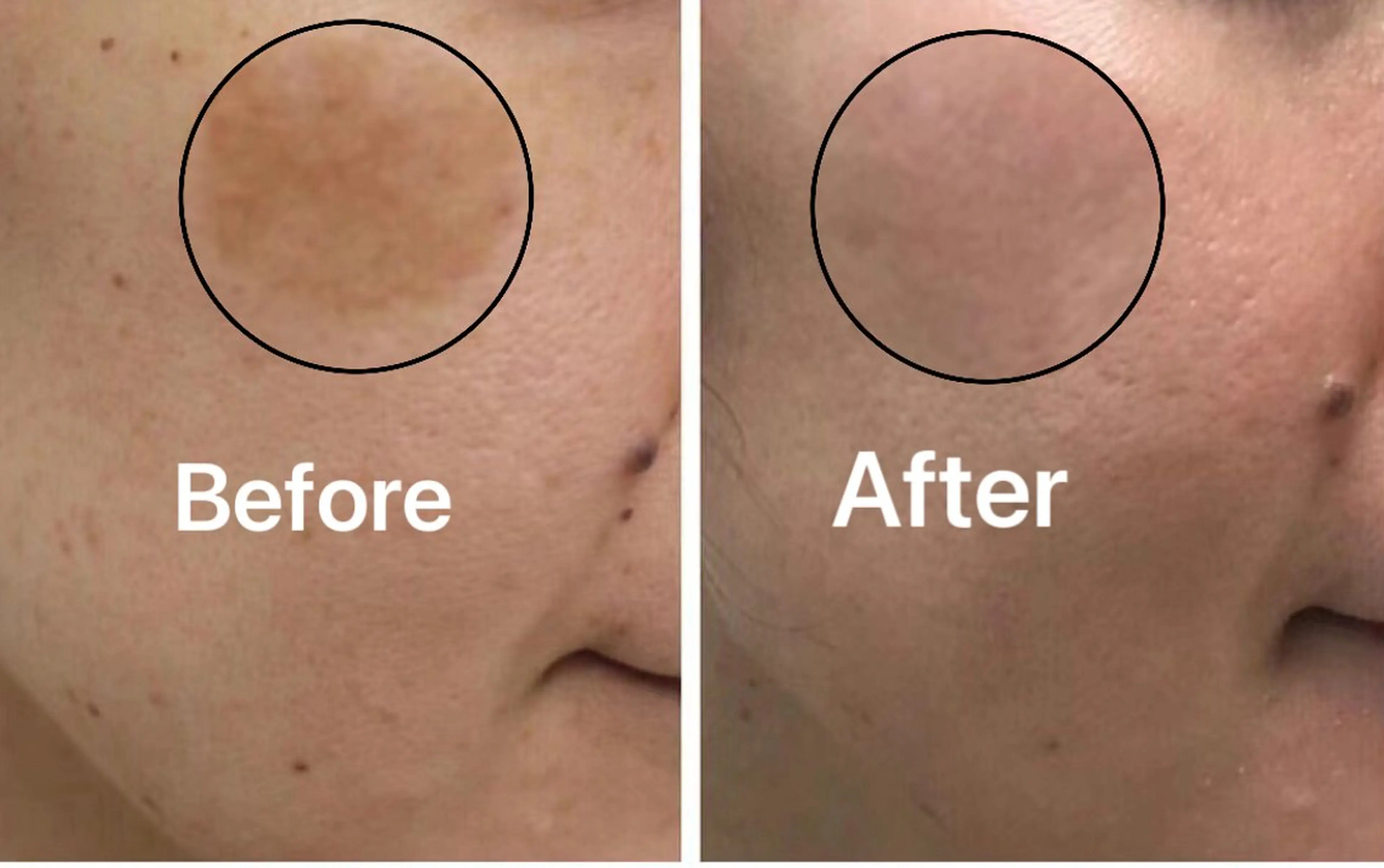 肌管理専門店 Shandeelのエステ・リラクイメージ