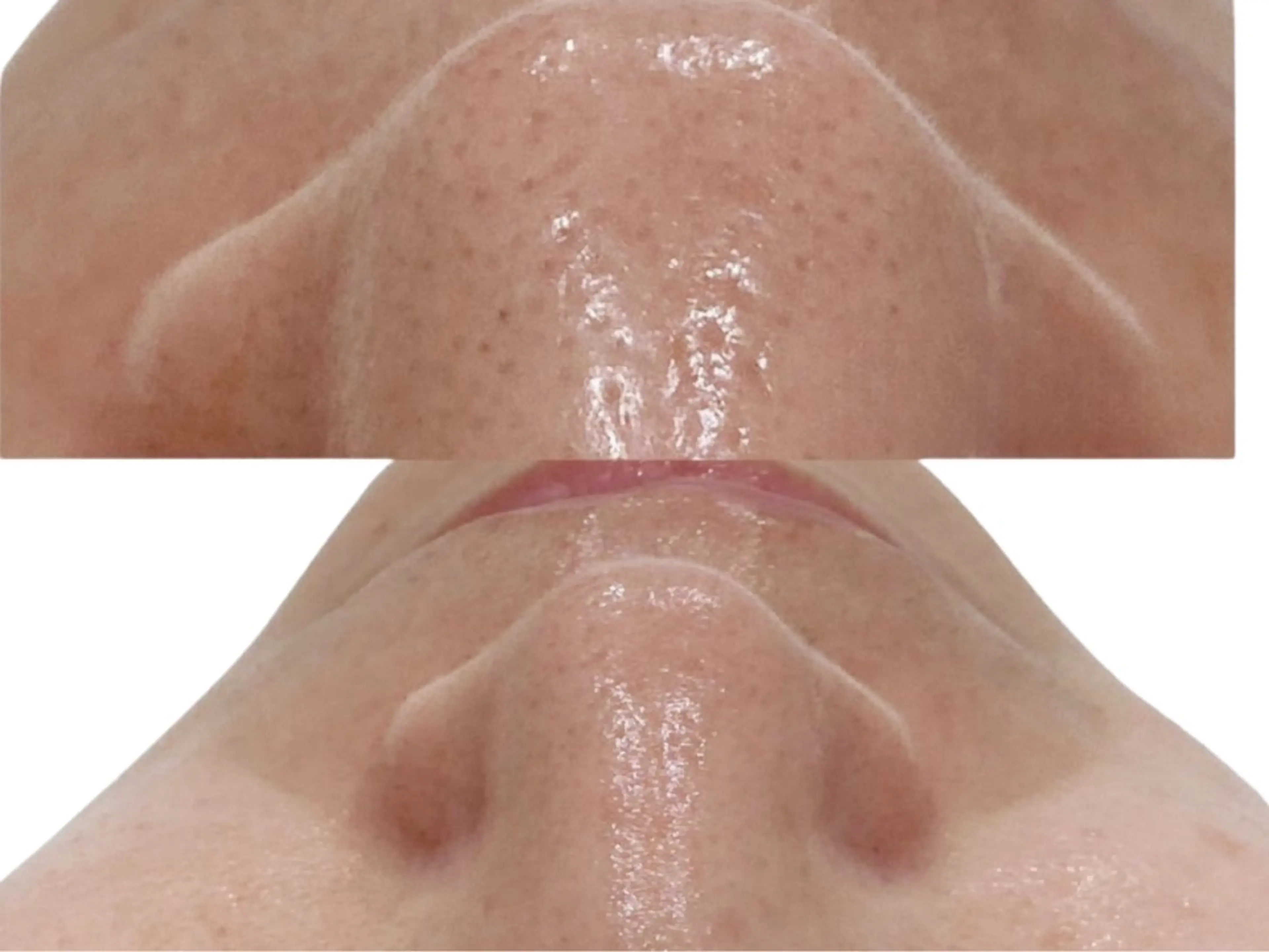 UI LANIのエステ・リラクイメージ