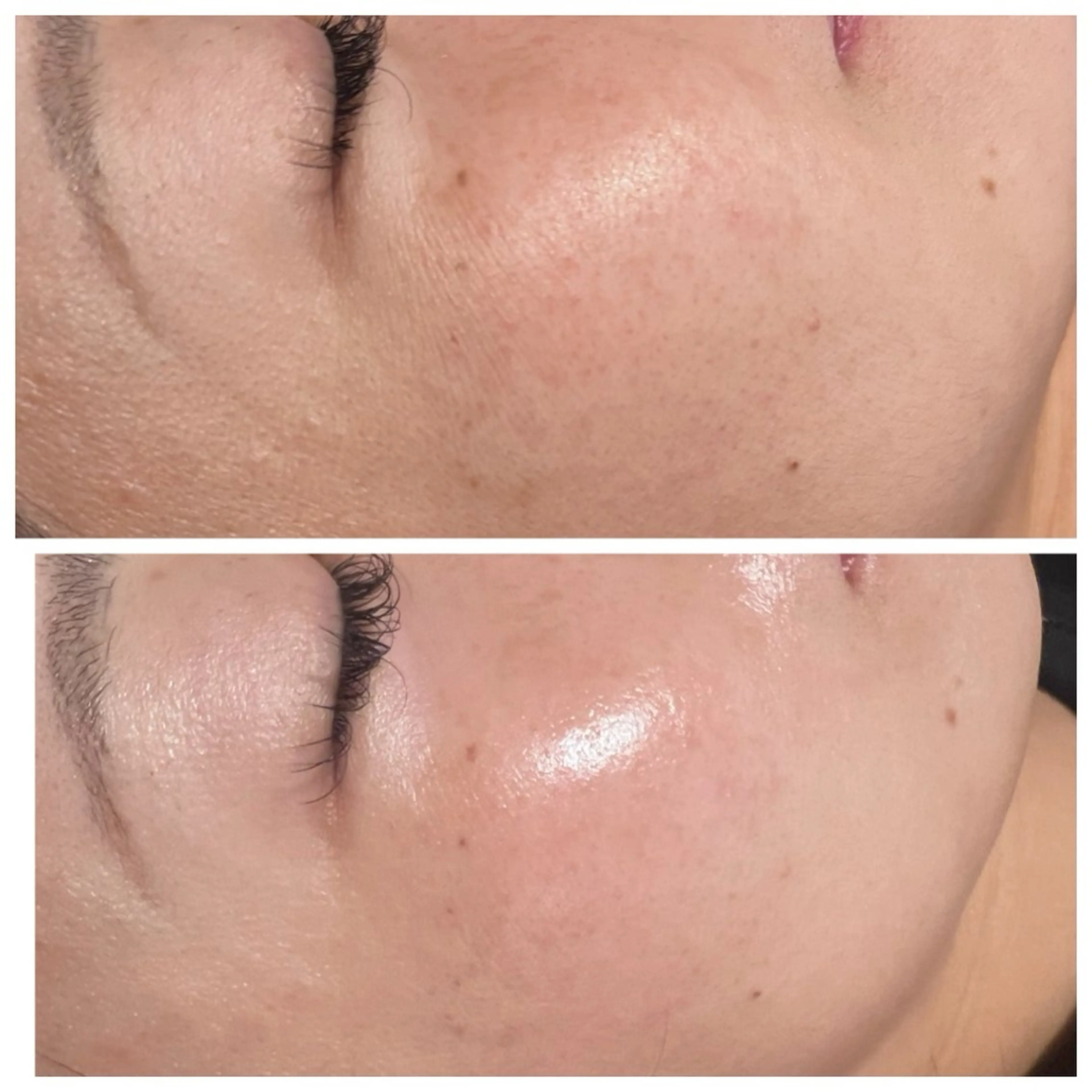 Raviy 【痩身・韓国肌管理】のエステ・リラクイメージ