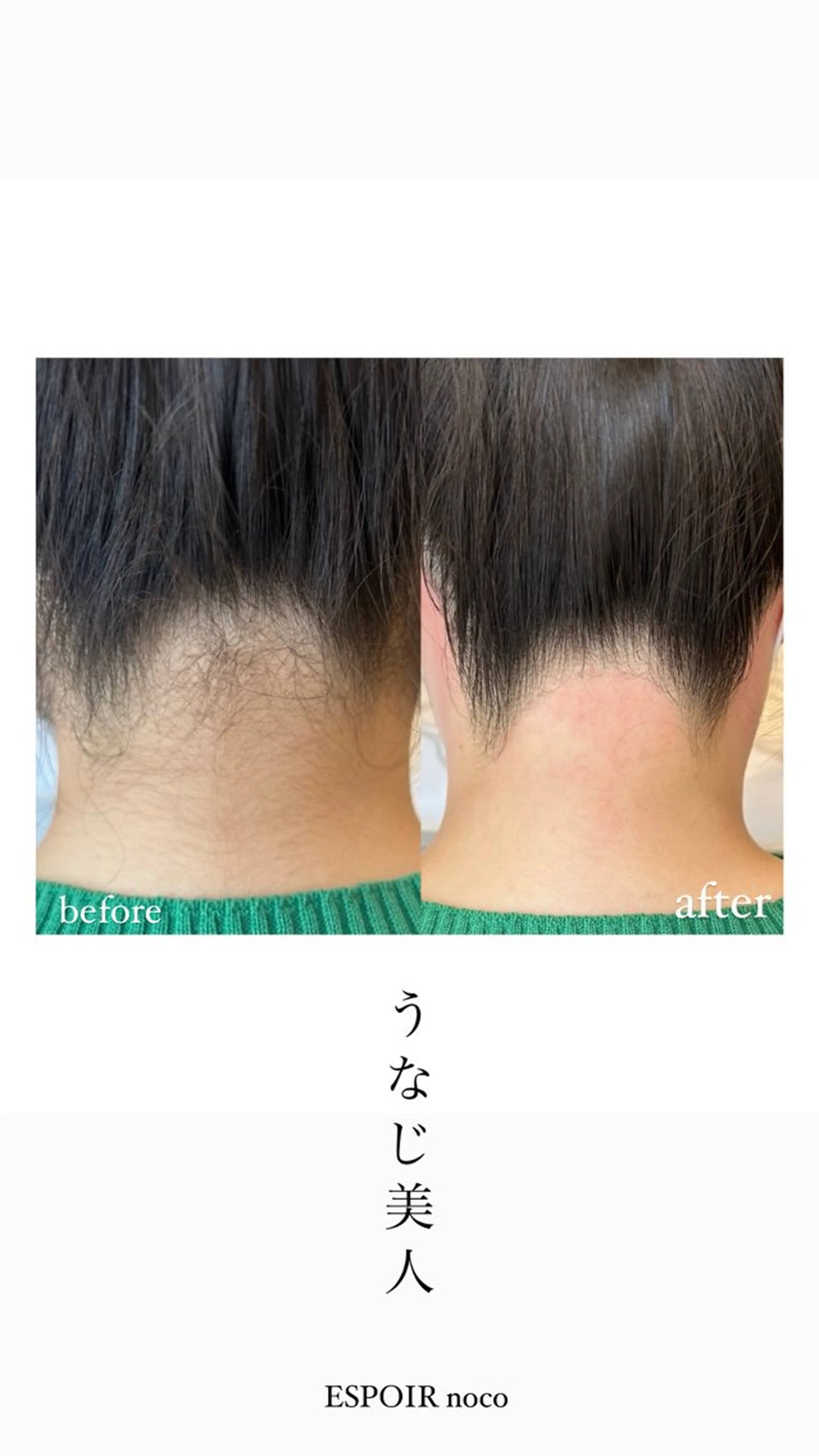 ワックス脱毛🌈 ESPOIRnocoのエステ・リラクイメージ