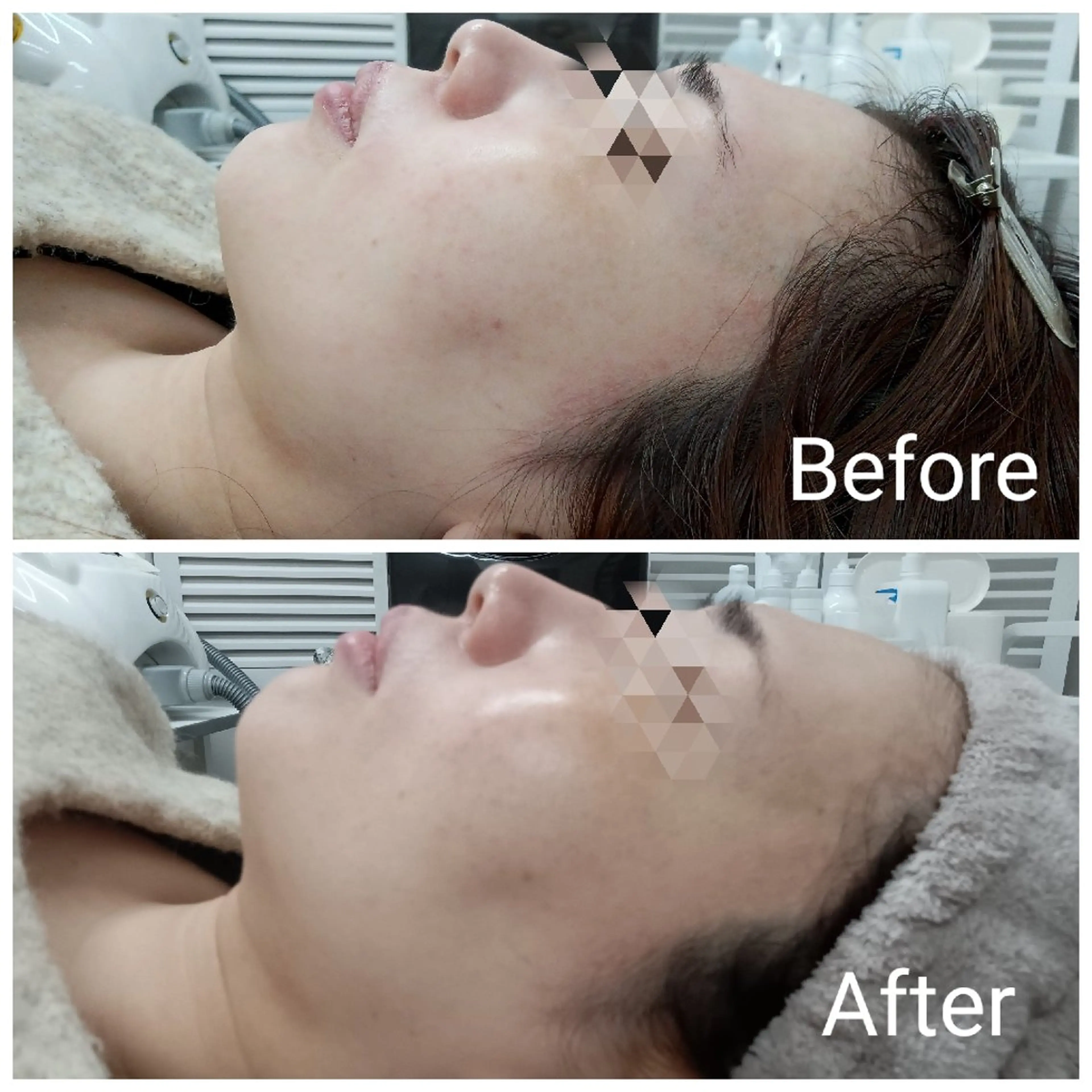 エステ リラク 肌質改善Beauty salon Renのエステ・リラクイメージ