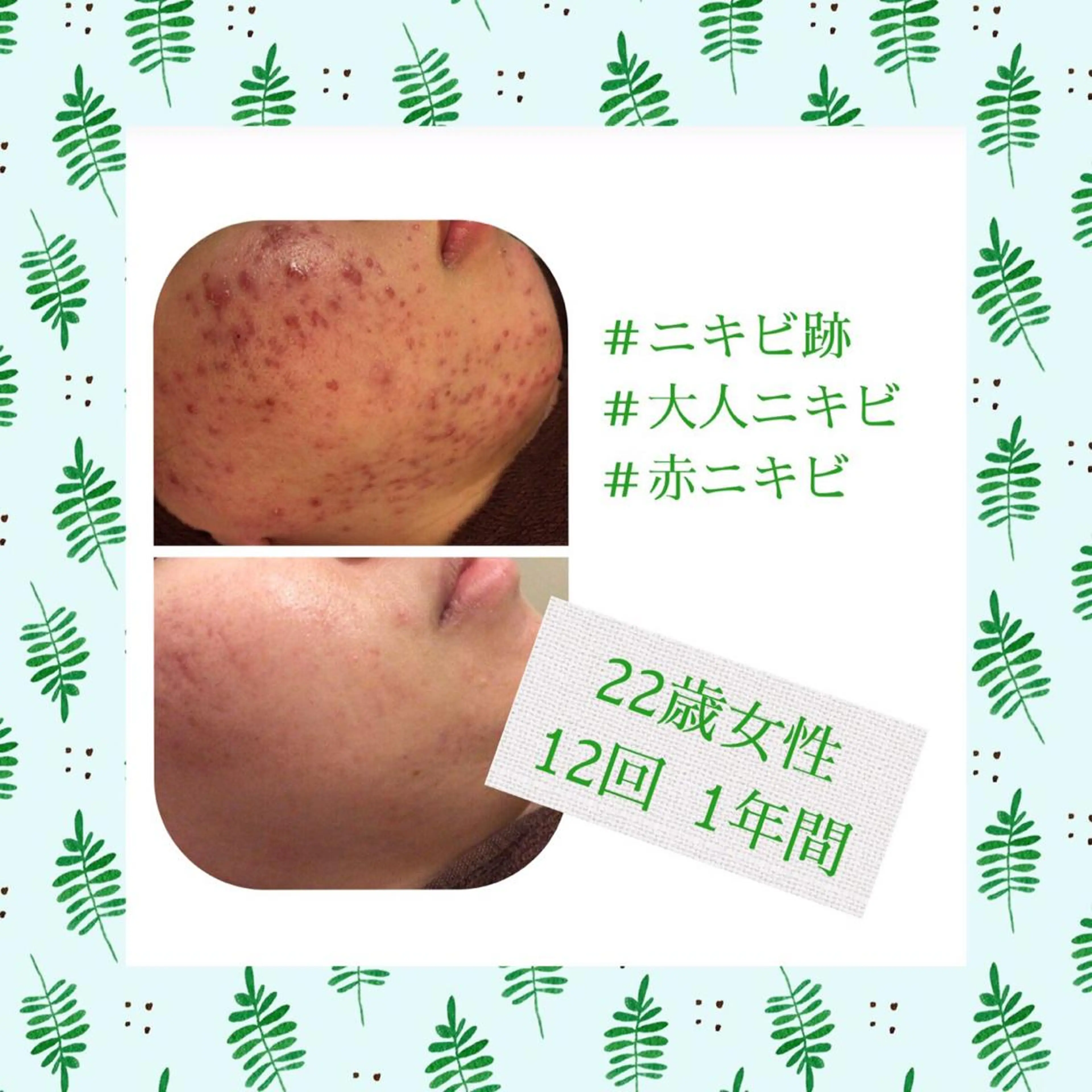 ミディアム カラー パーマ ヘアアレンジ メンズ キッズ ネイル マツエク・マツパ ニキビ・肌質改善専門 ♡人生が変わるサロンのエステ・リラクイメージ