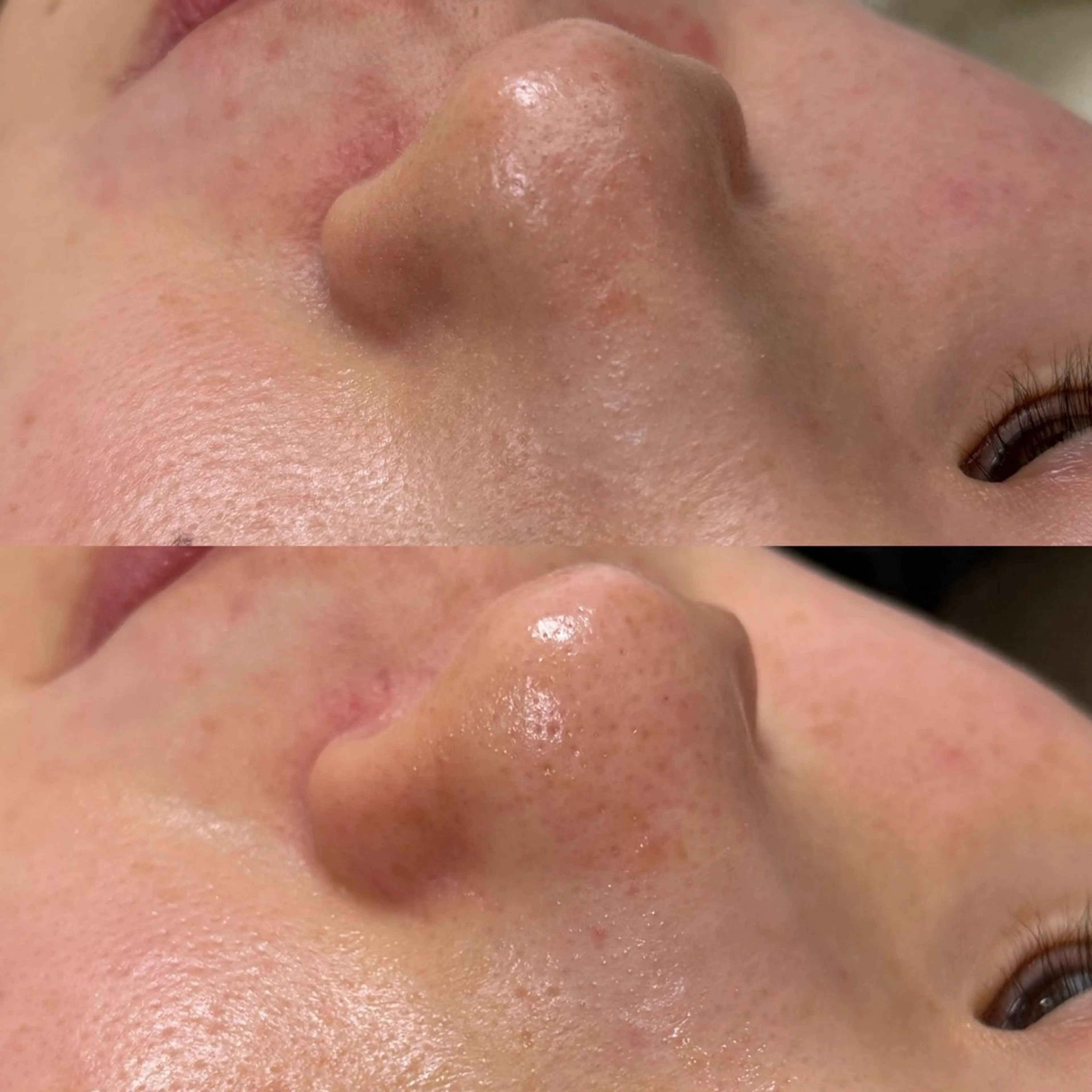 エステ 毛穴と脱毛のお店 "Lea" 壷林のエステ・リラクイメージ