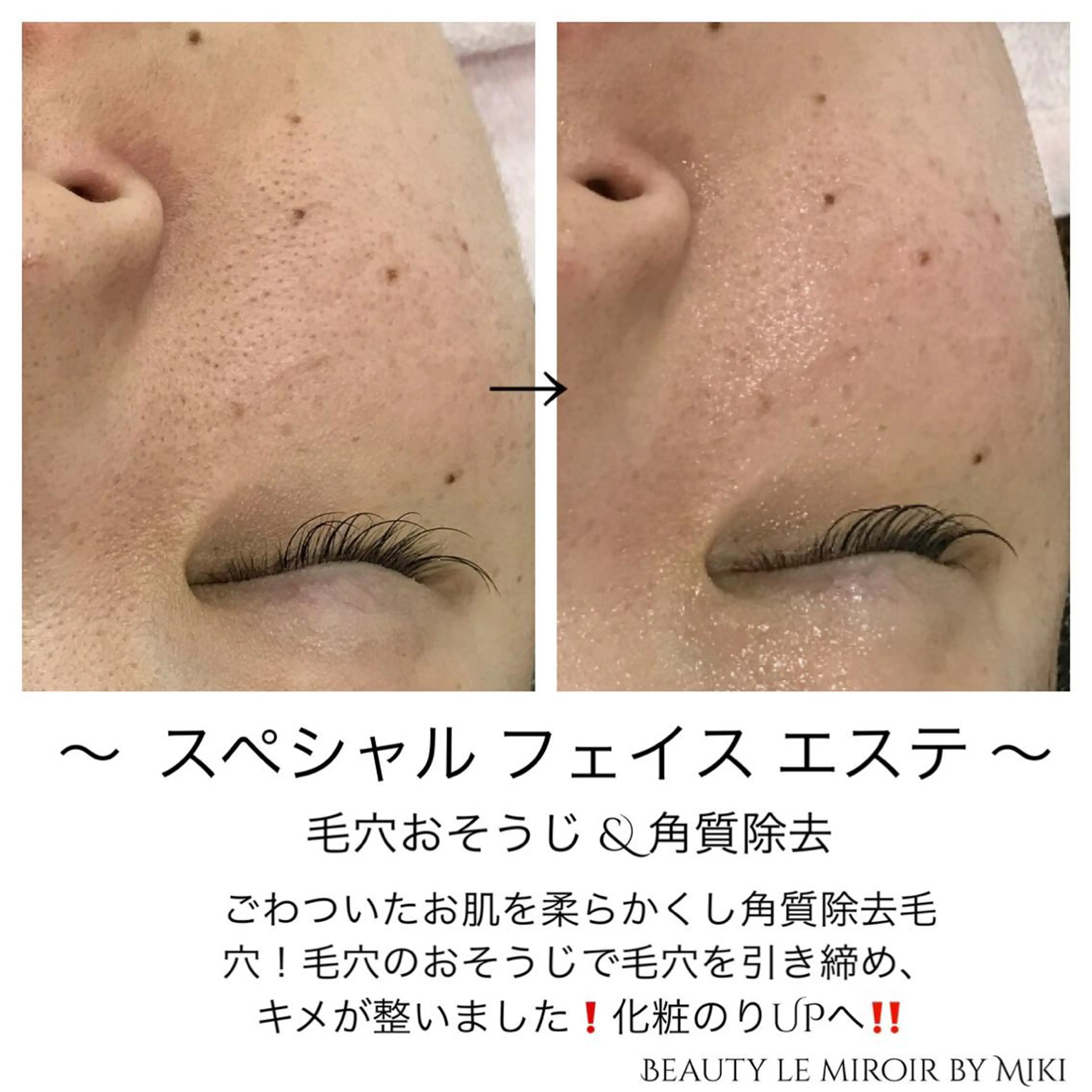 ビューティー ミロワールのエステ・リラクイメージ