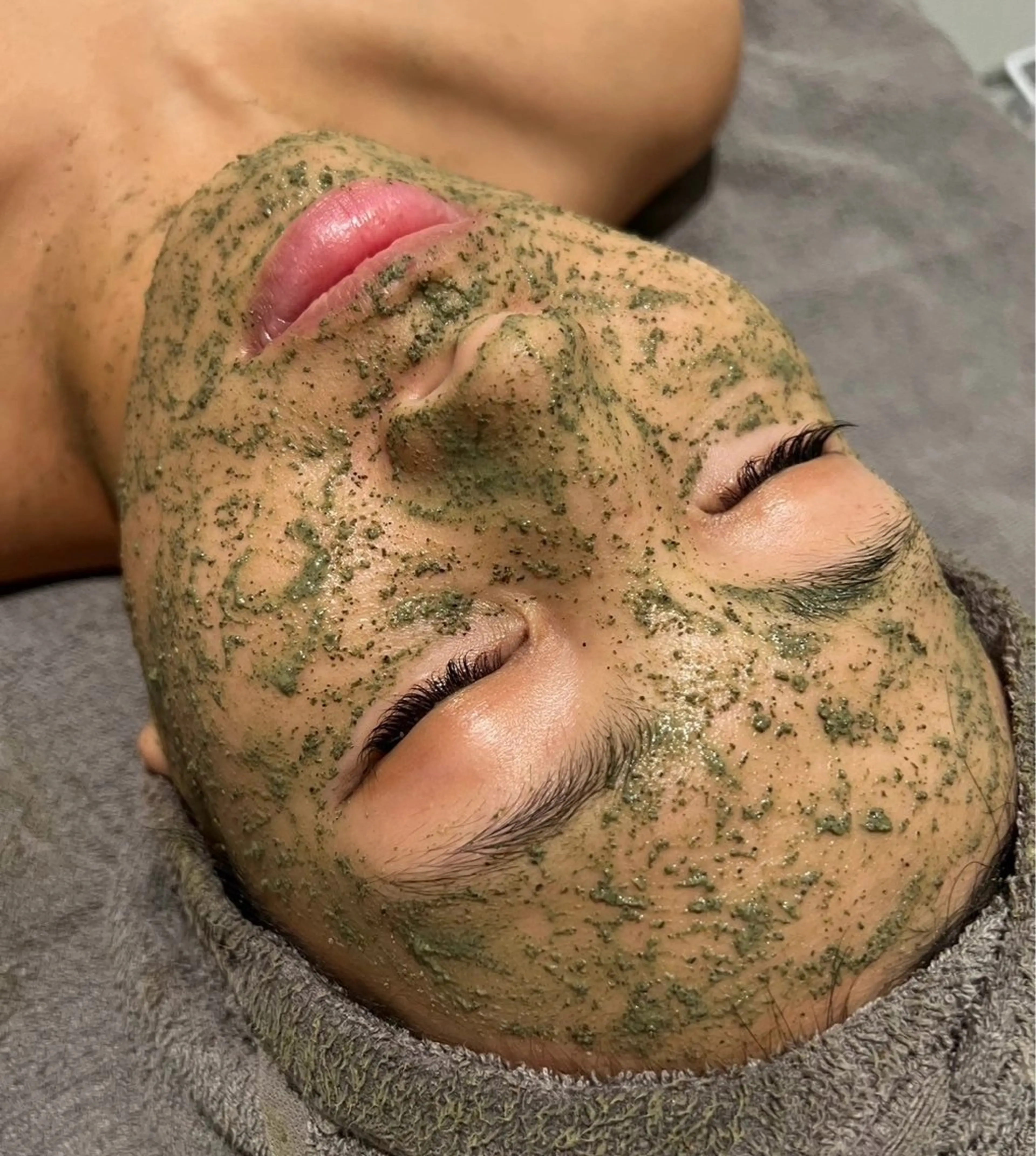 【本日限定】陶肌🌿ハーブピーリング(美容液導入プレゼント)の写真