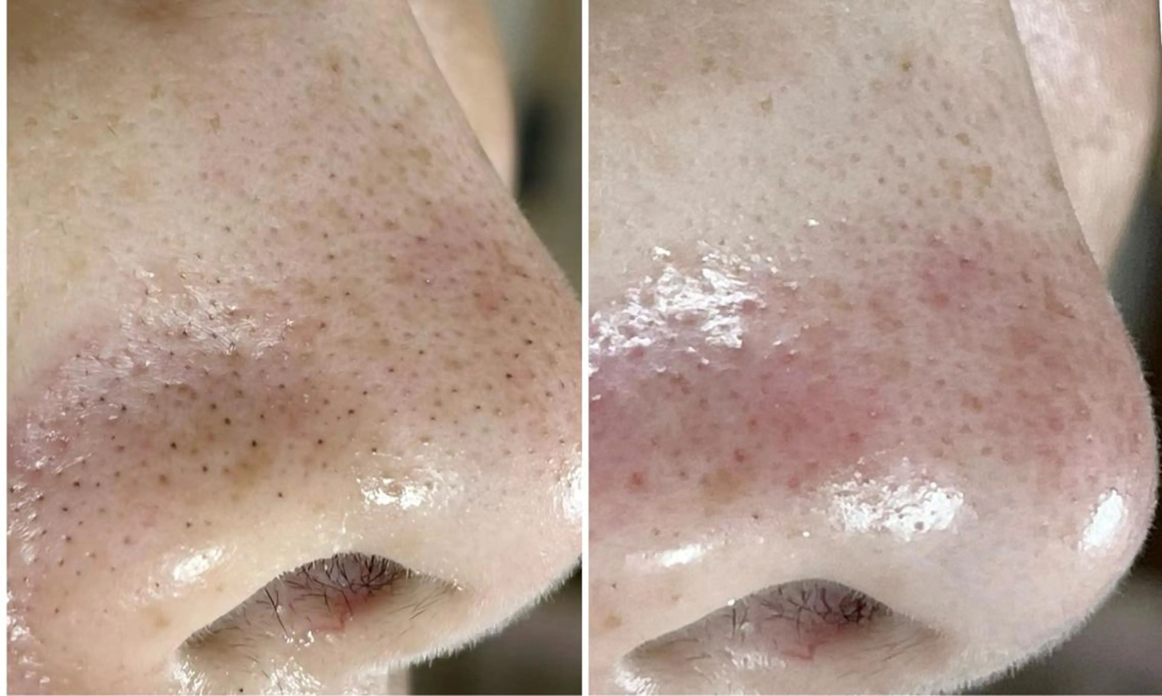 C. Lのマツエク・マツパデザイン