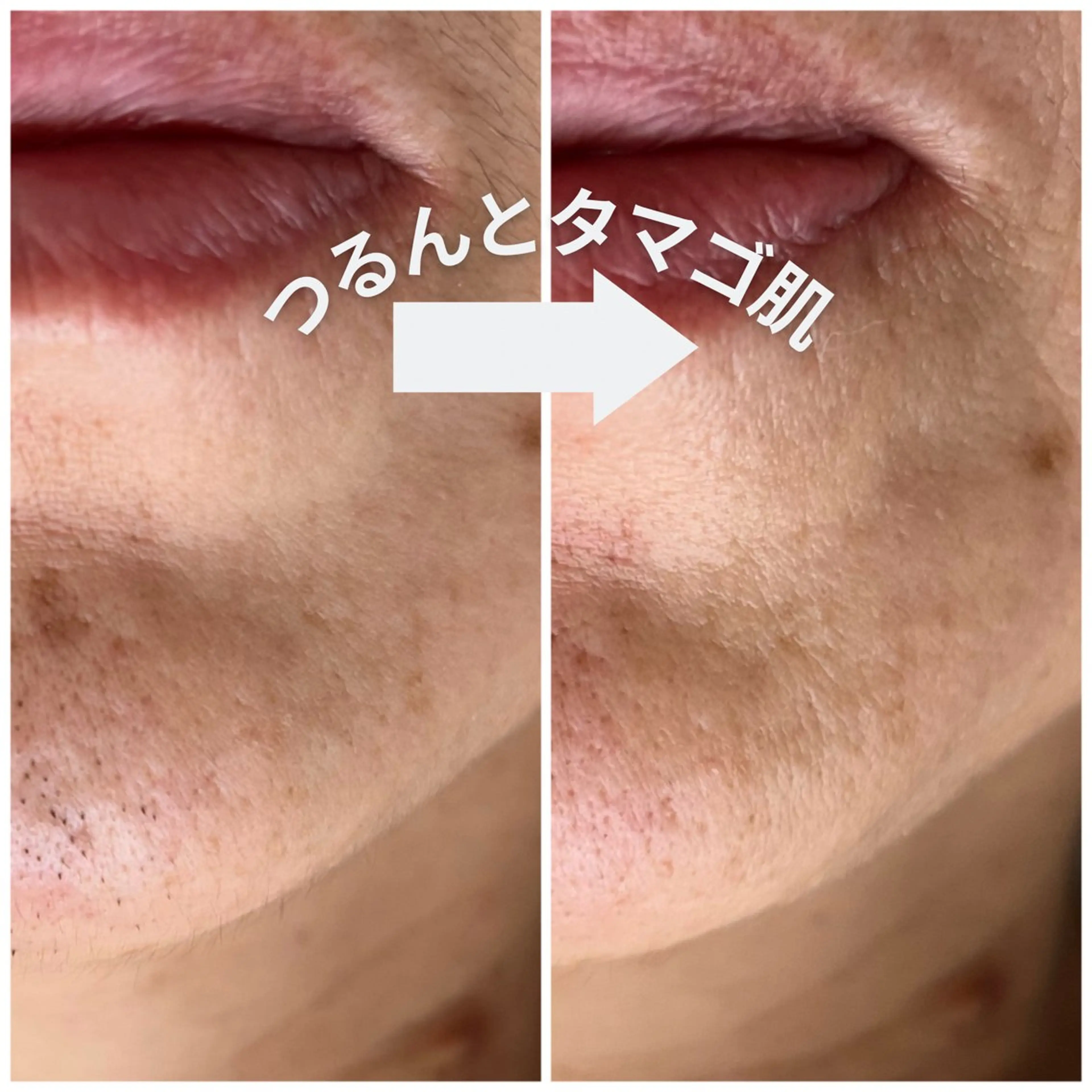 脱毛 幸手駅前Frays ‎🧡あやかのマツエク・マツパデザイン