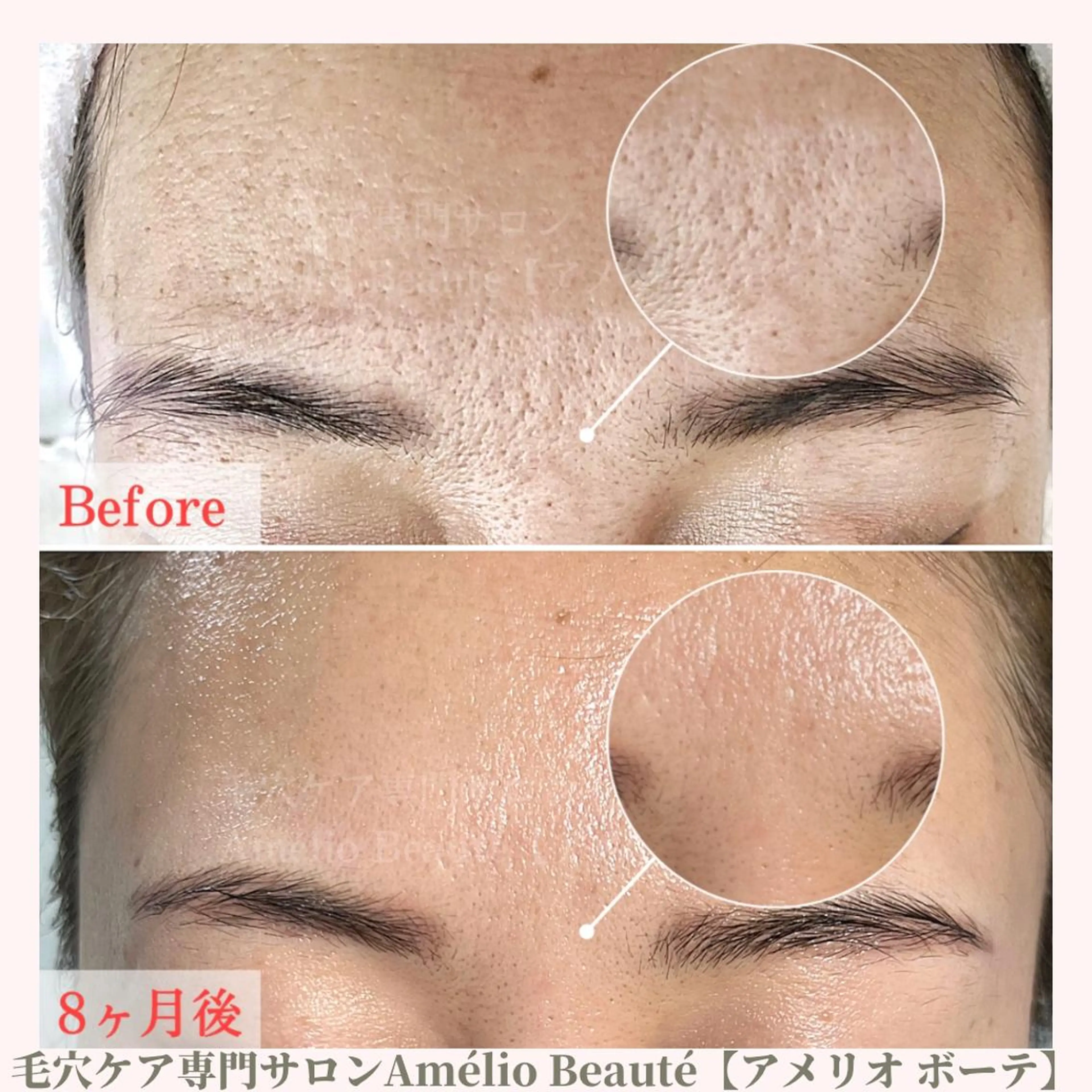 無料カウンセリング （施術無し）の写真