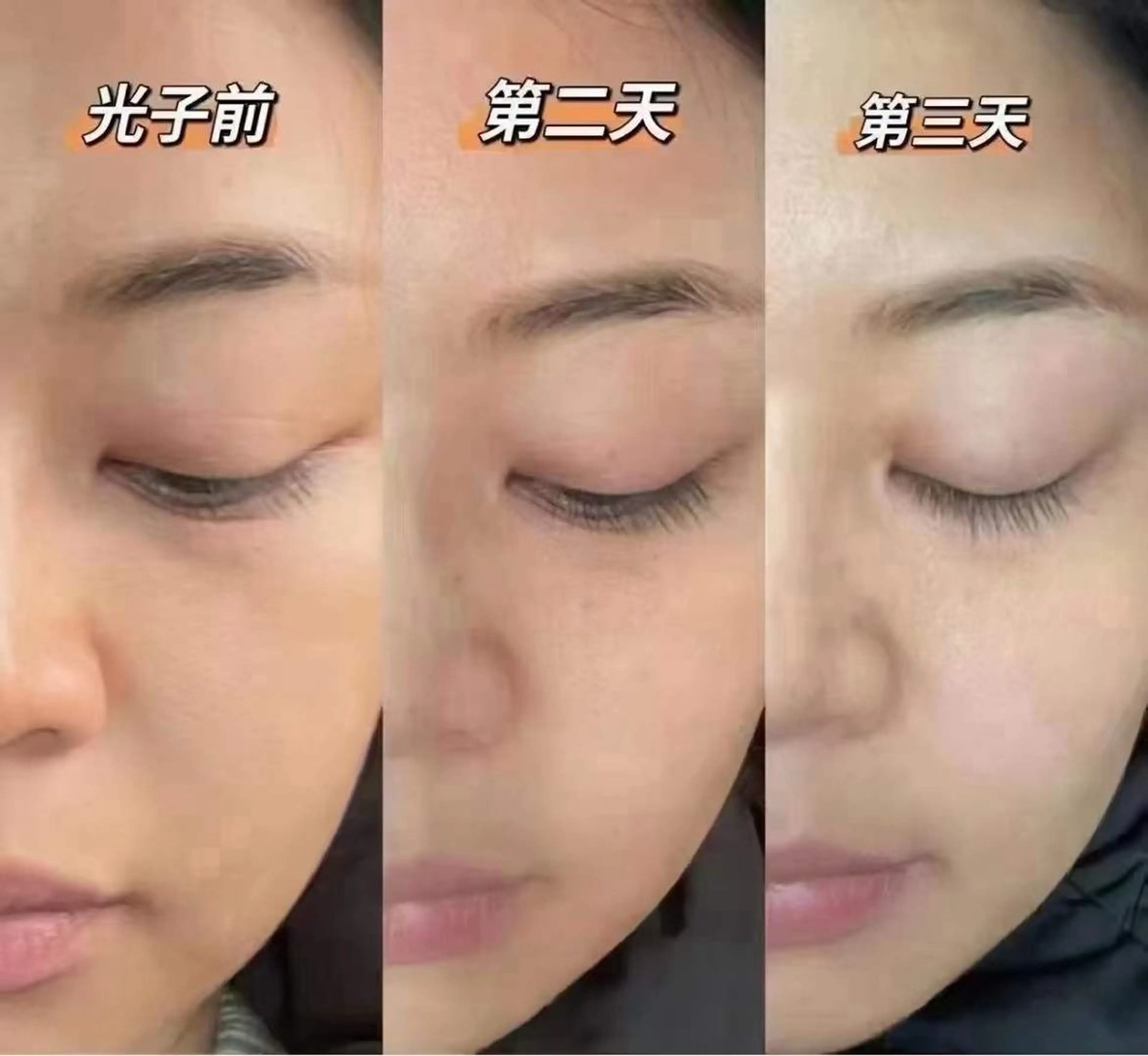 ネイル 韓国ネイル エステ aliaハーブ水光店 エステティシャン募集のエステ・リラクイメージ