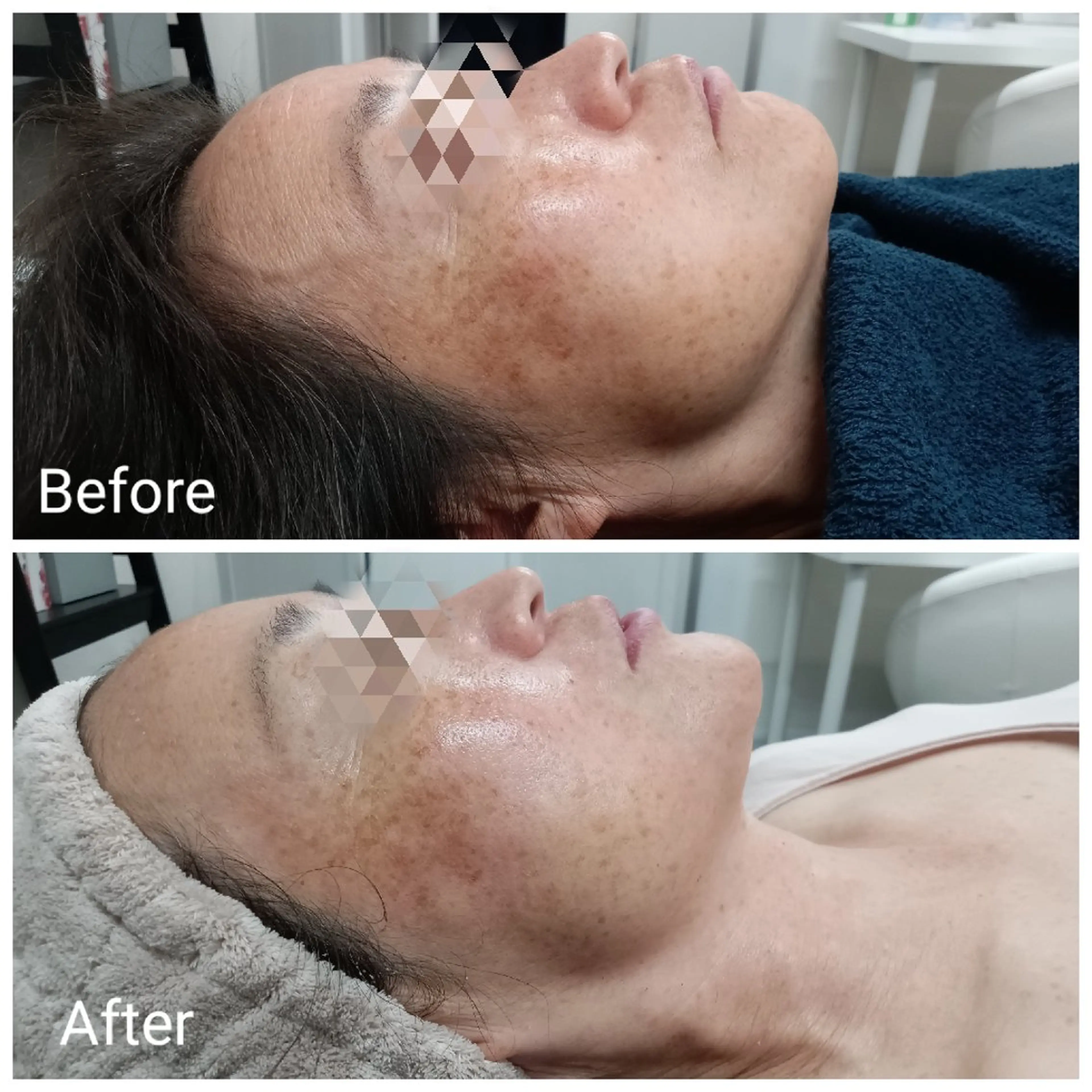 肌質改善Beauty salon Renのエステ・リラクイメージ