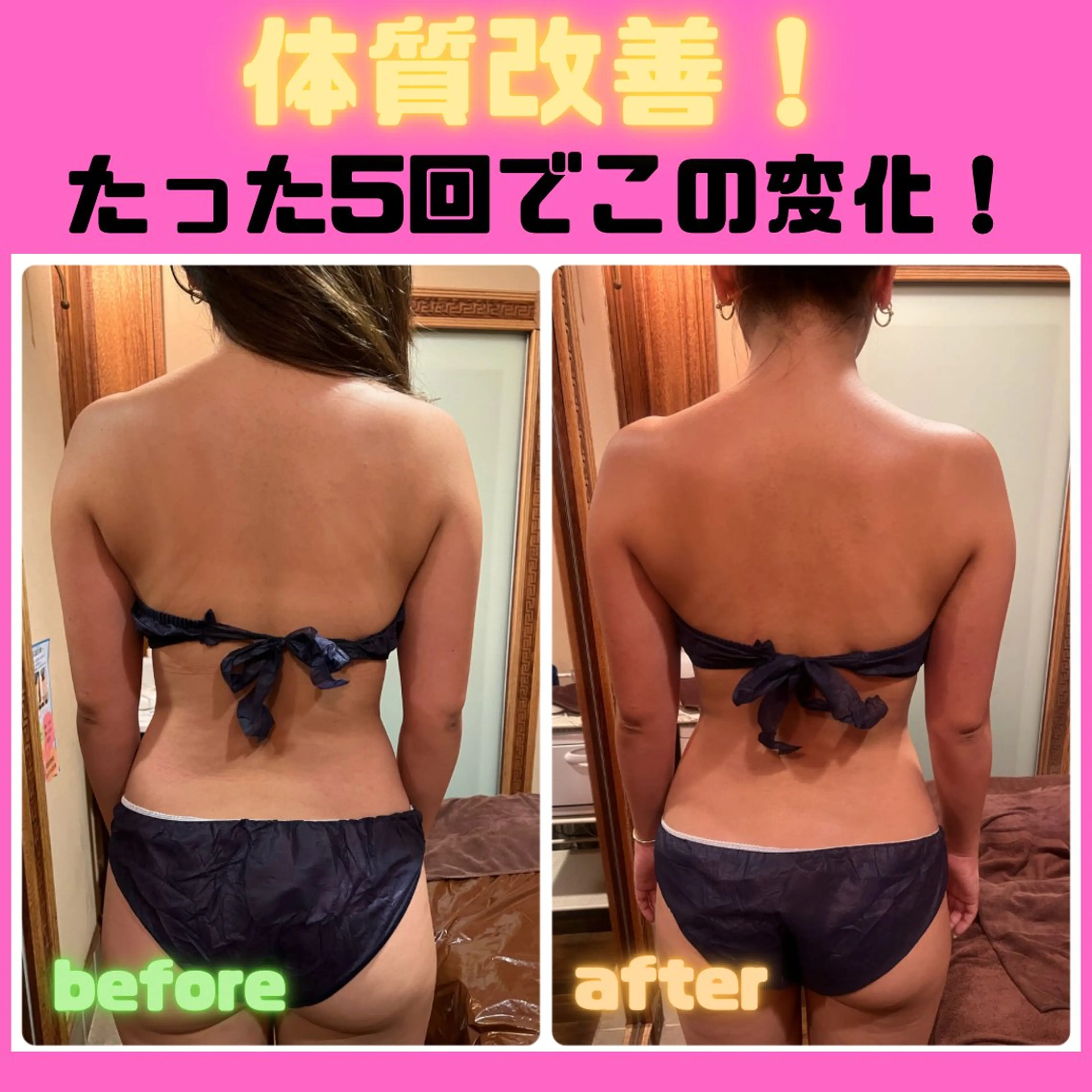 エステ リラク 痩身&美肌サロン 堀米✨のその他イメージ