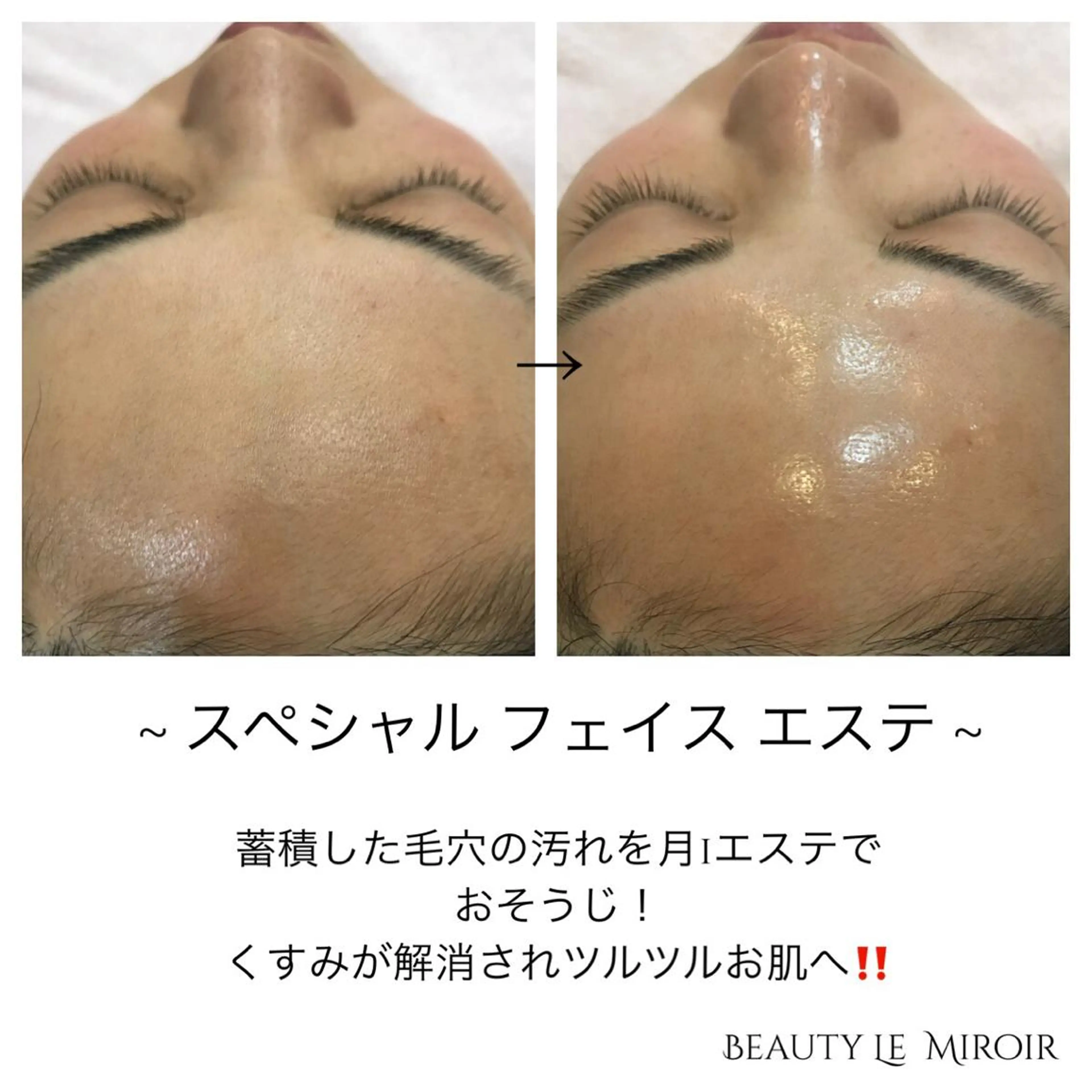 ビューティー ミロワールのエステ・リラクイメージ