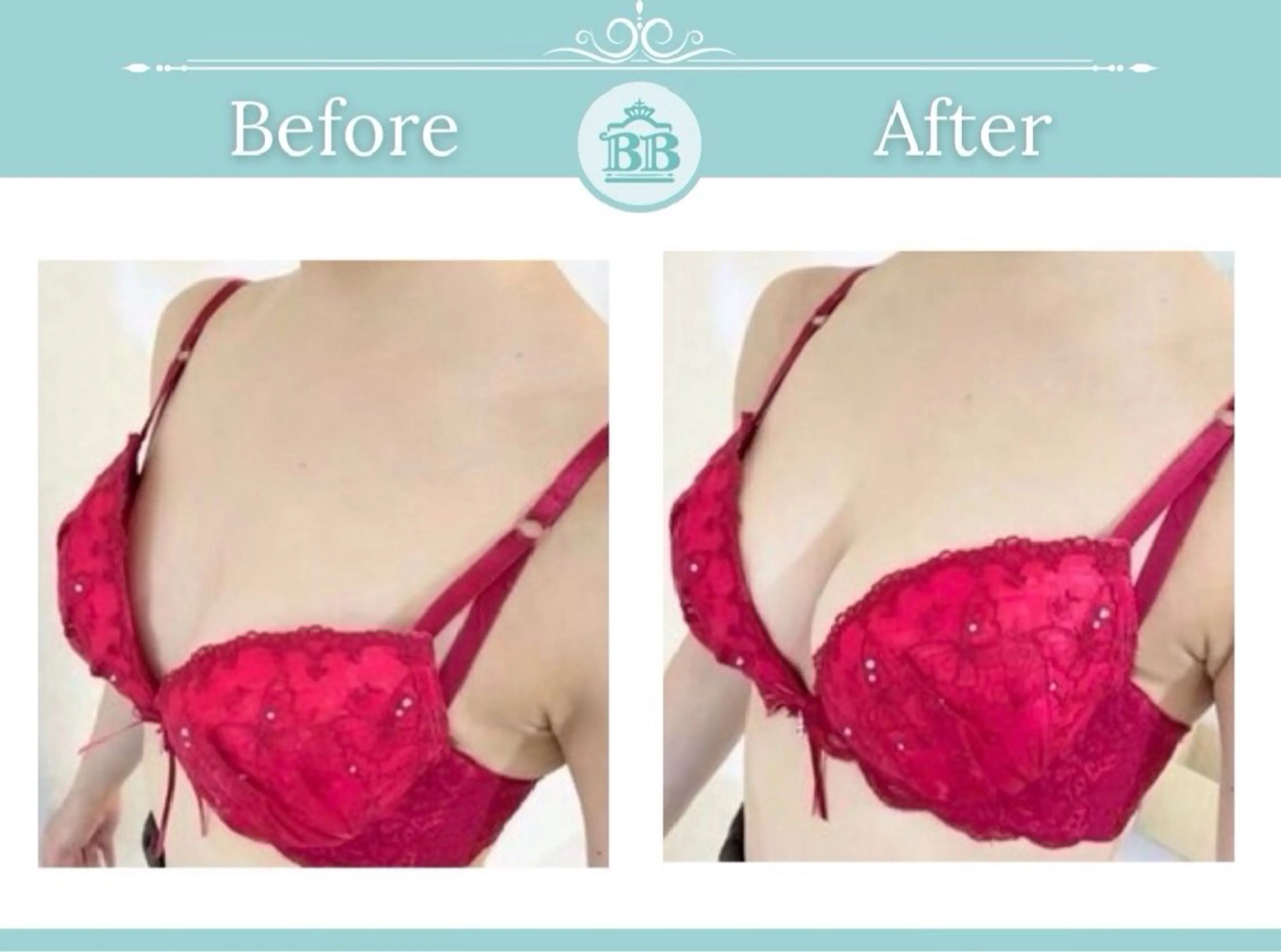 エステ 美人バスト本厚木店所属・美人バスト 本厚木店のエステ・リラクイメージ