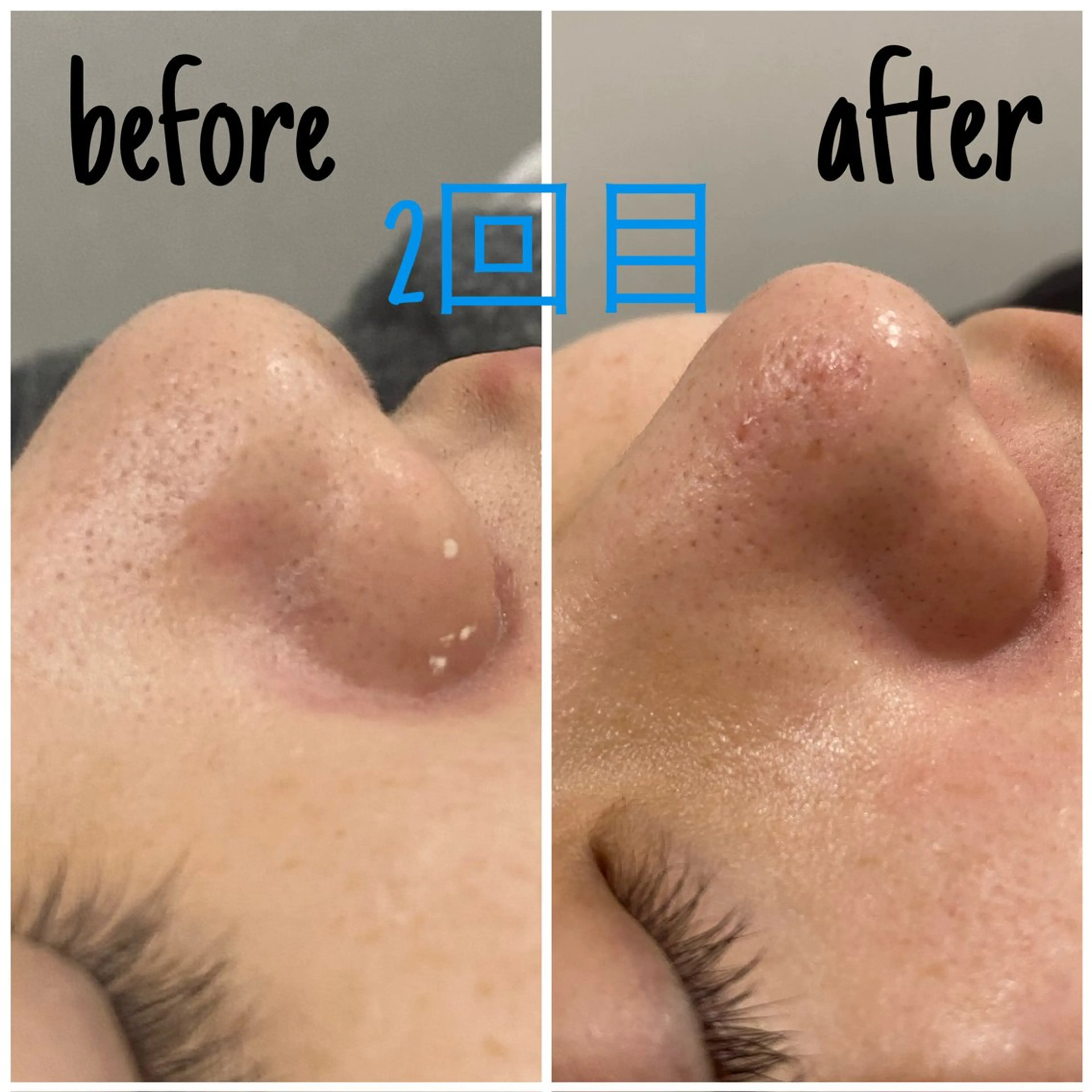 エステ 痩身/毛穴洗浄/脱毛 アルカンジュのエステ・リラクイメージ