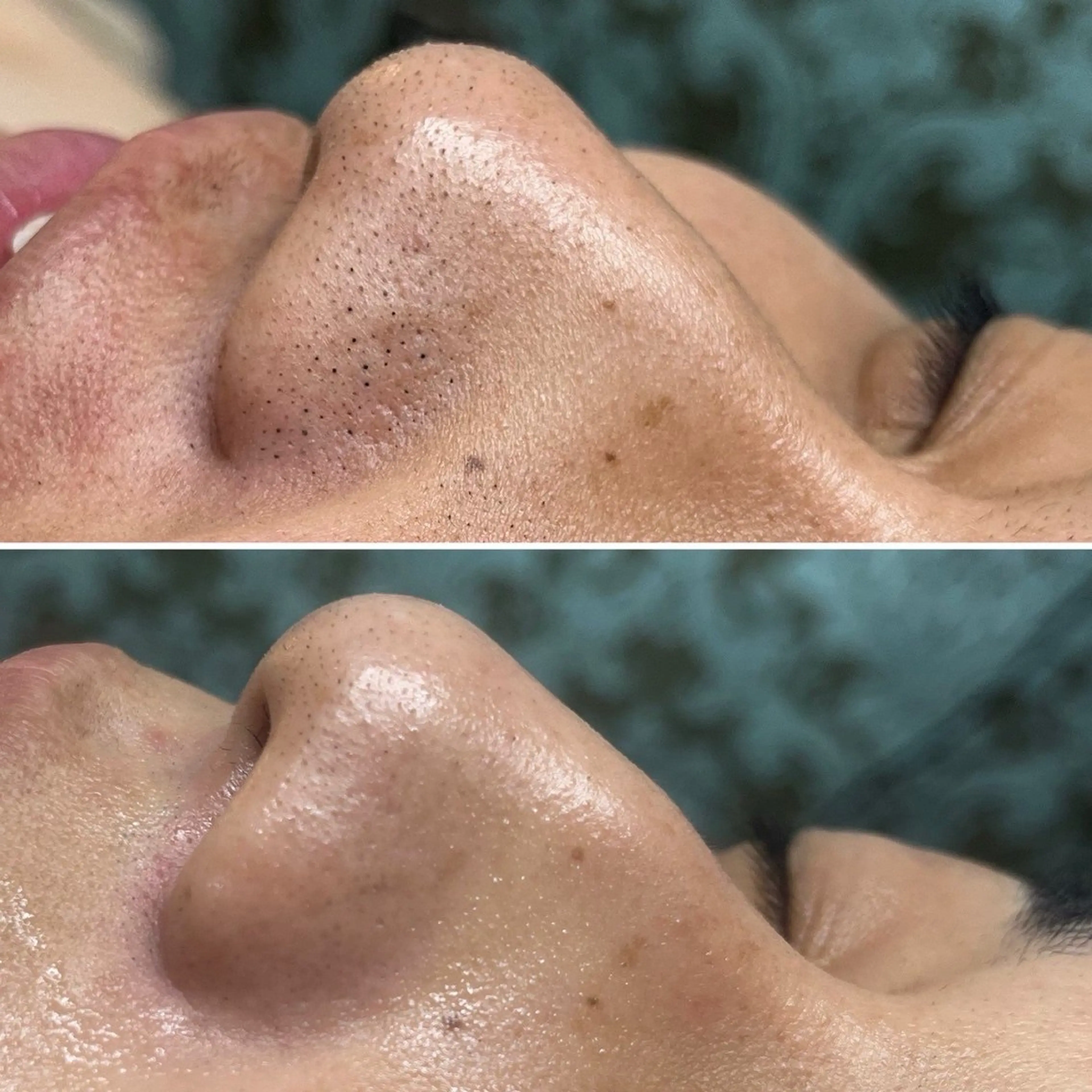 エステ フェイシャル/脱毛 ジョアアンジェ竹田のエステ・リラクイメージ