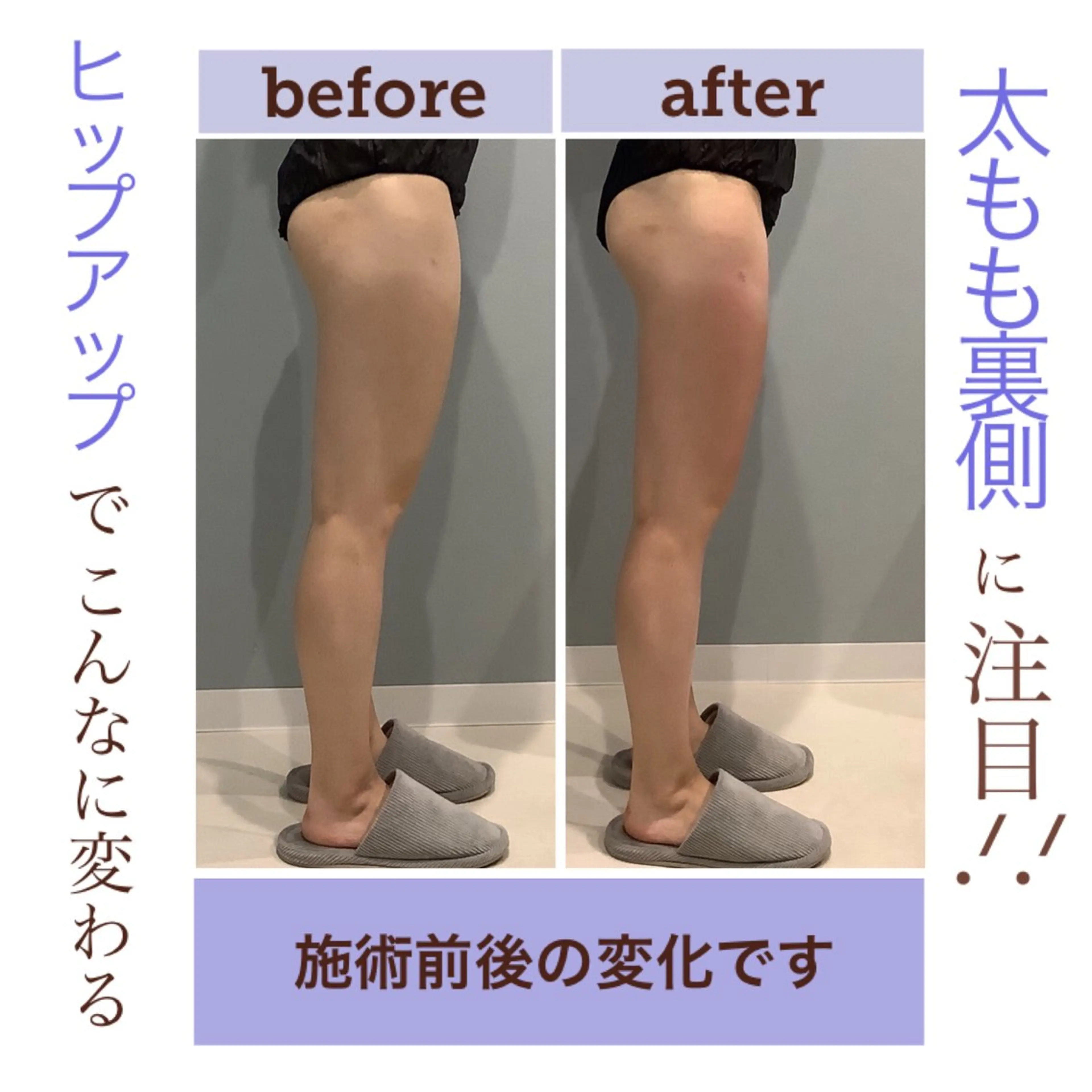 エステ エステサロン JURISのエステ・リラクイメージ