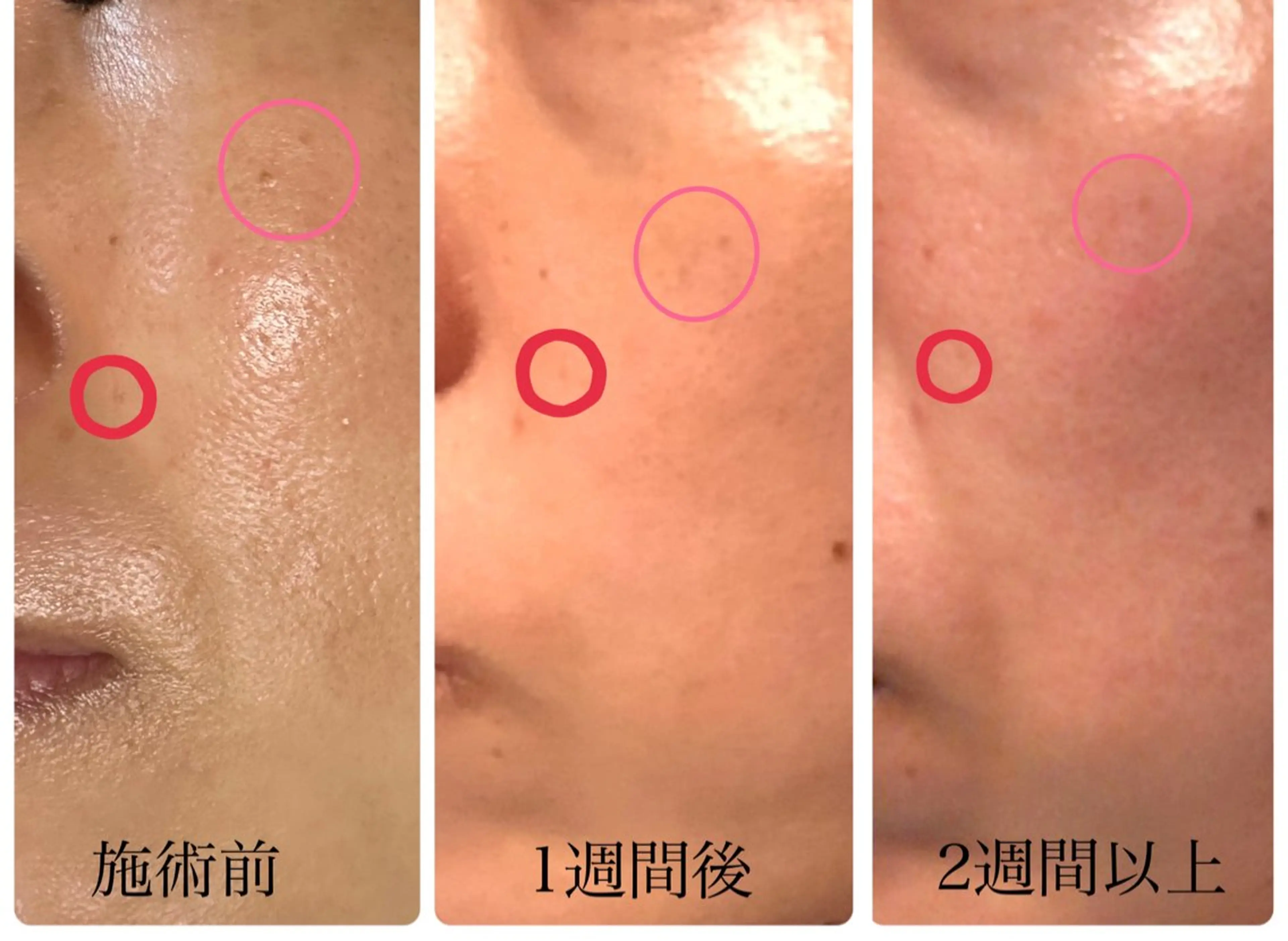 バストアップ専門/デ トックス/小顔コルギのエステ・リラクイメージ