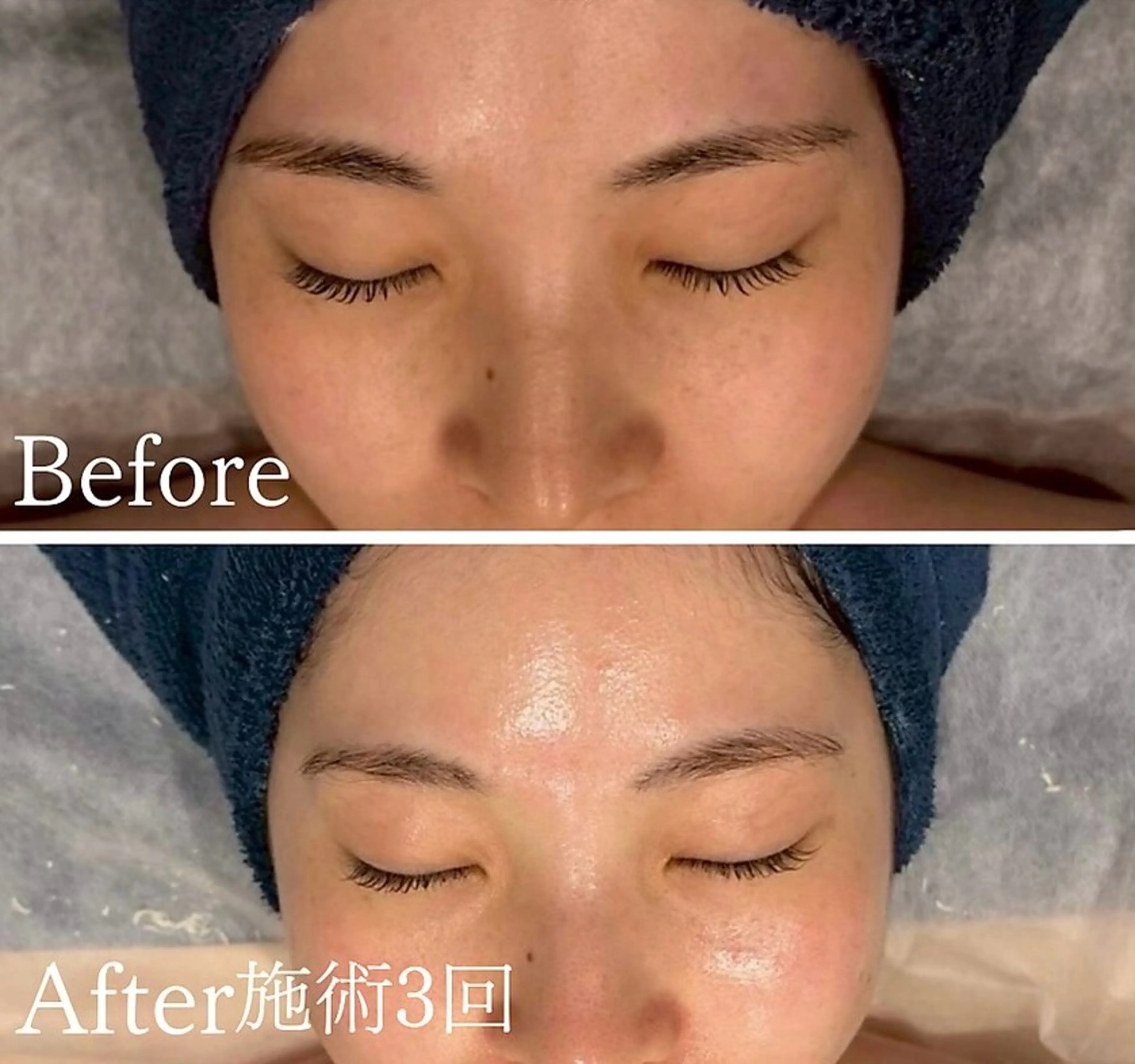 アンド ミルルのエステ・リラクイメージ