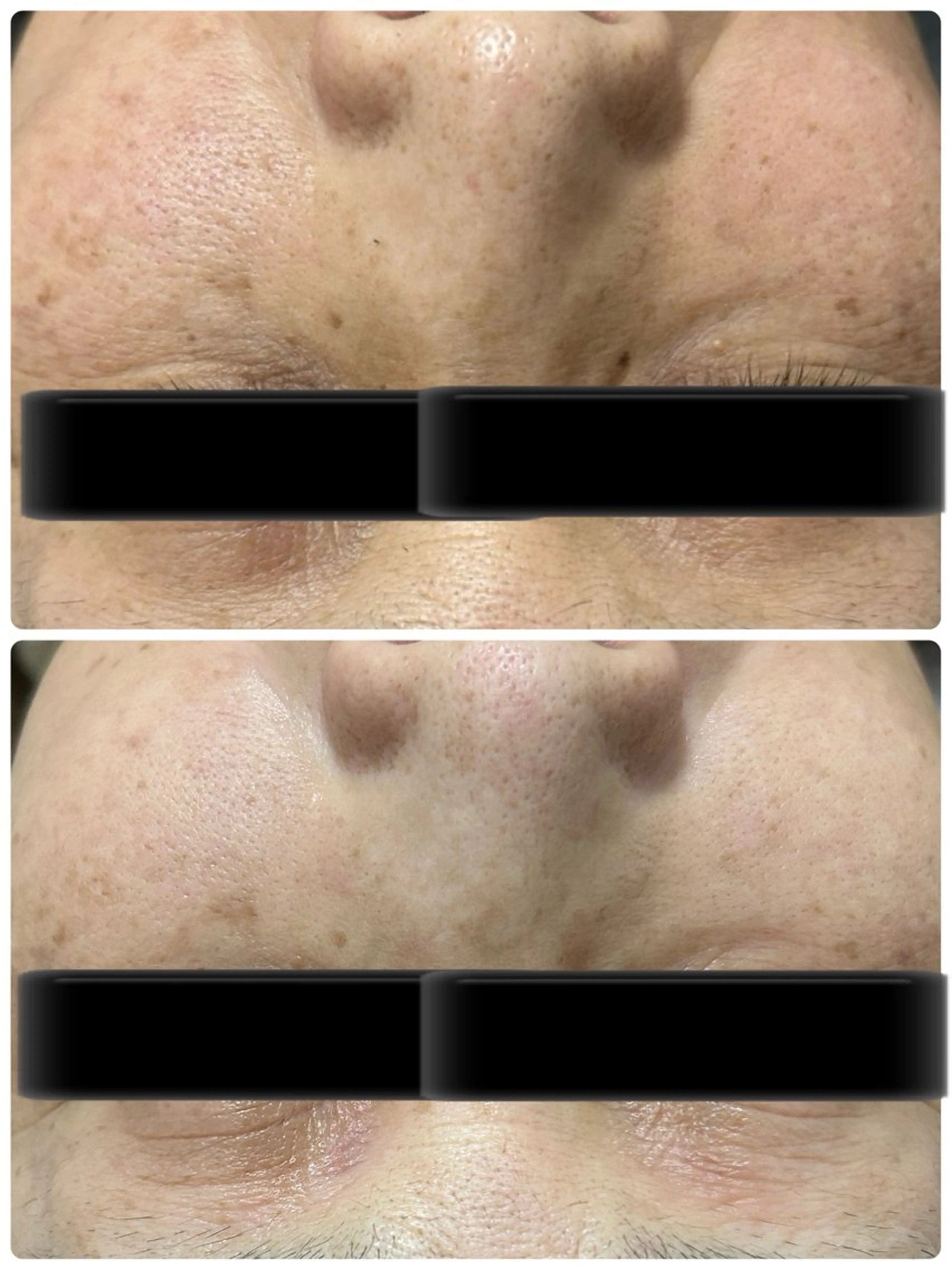 その他 小顔美肌痩身サロン Ranのその他イメージ