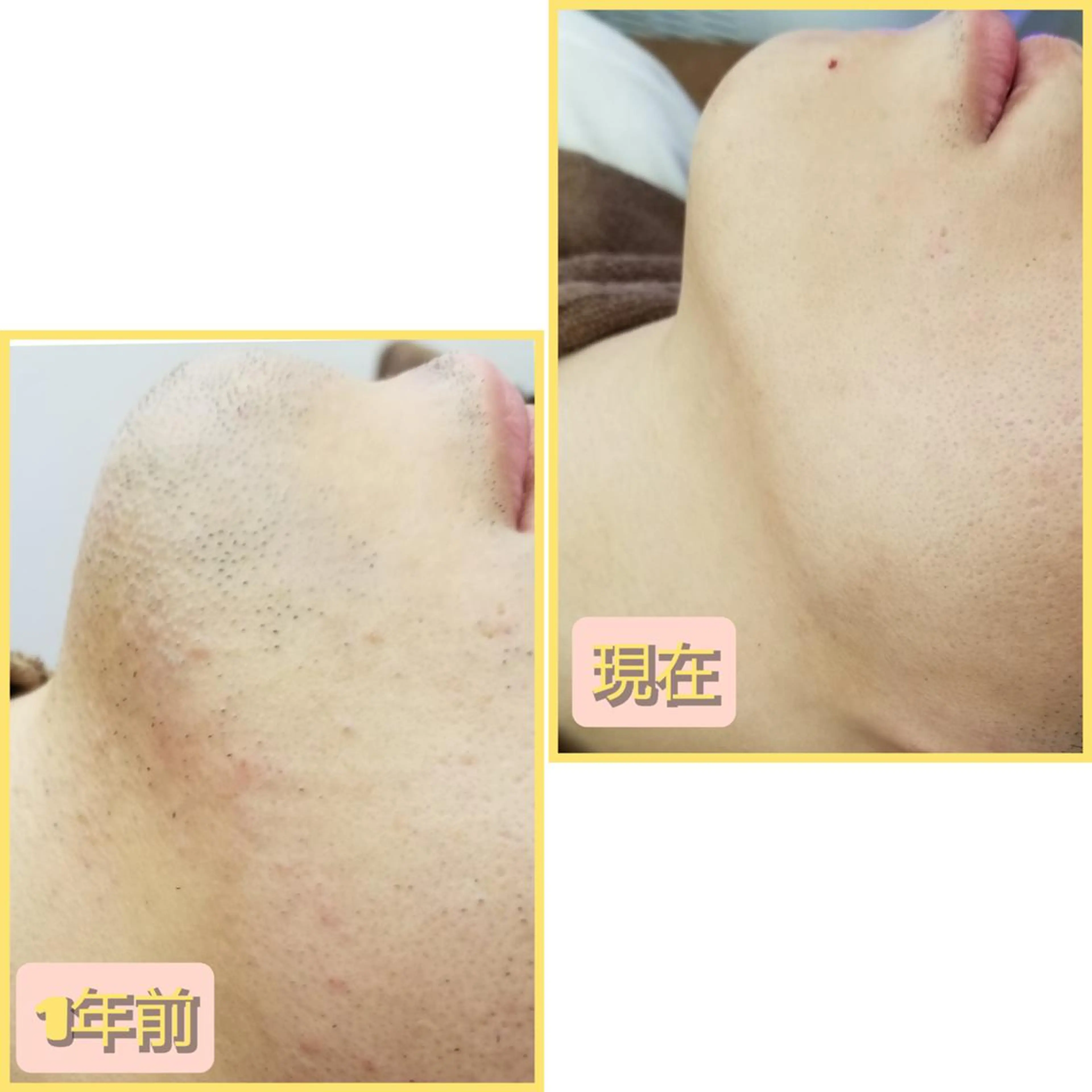 メンズ 脱毛 salonde ReGodのエステ・リラクイメージ