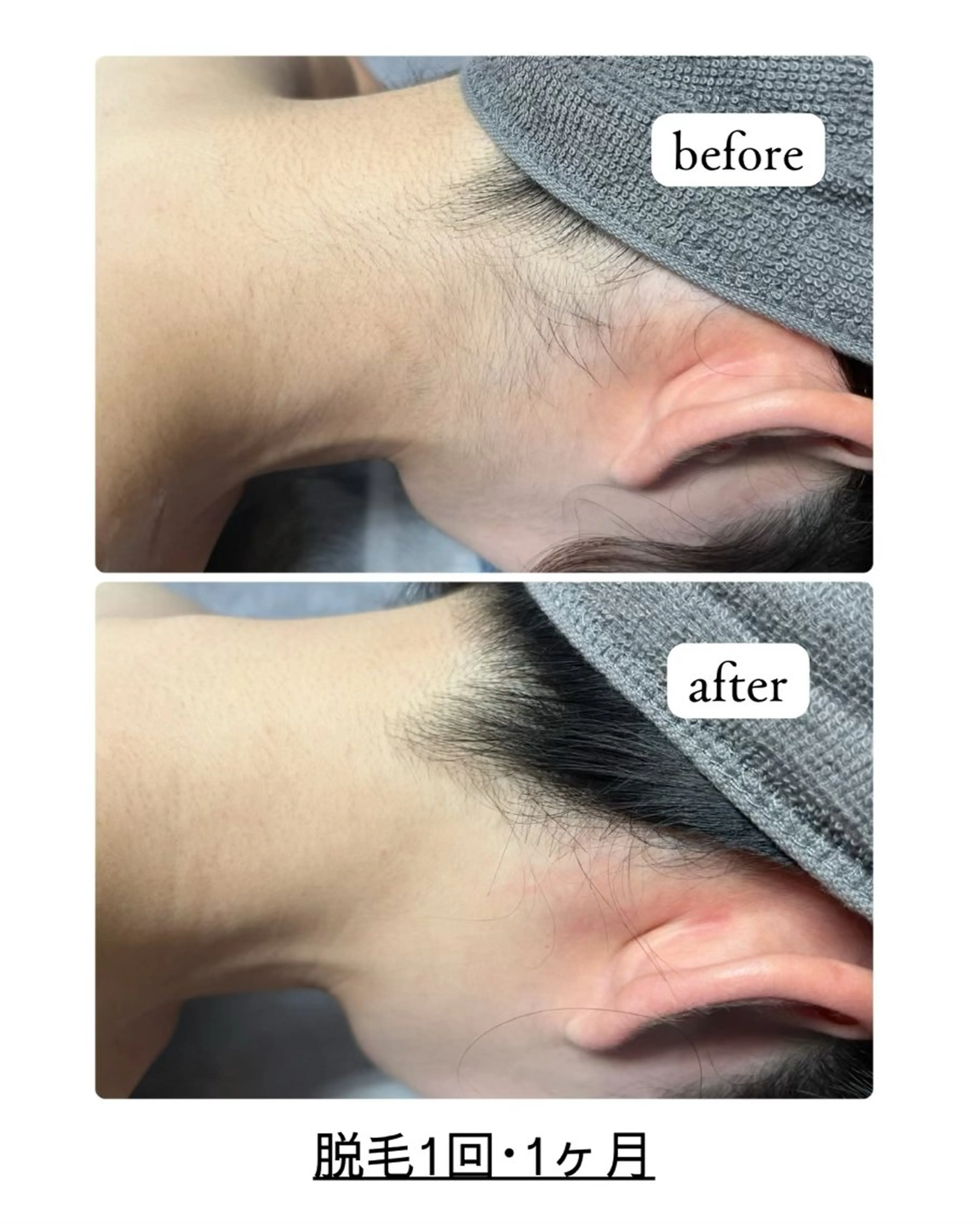 脱毛 blue.【都度払い脱毛&フェイシャルサロン】所属・blue.💙【 脱毛&フェイシャル】のエステ・リラクイメージ