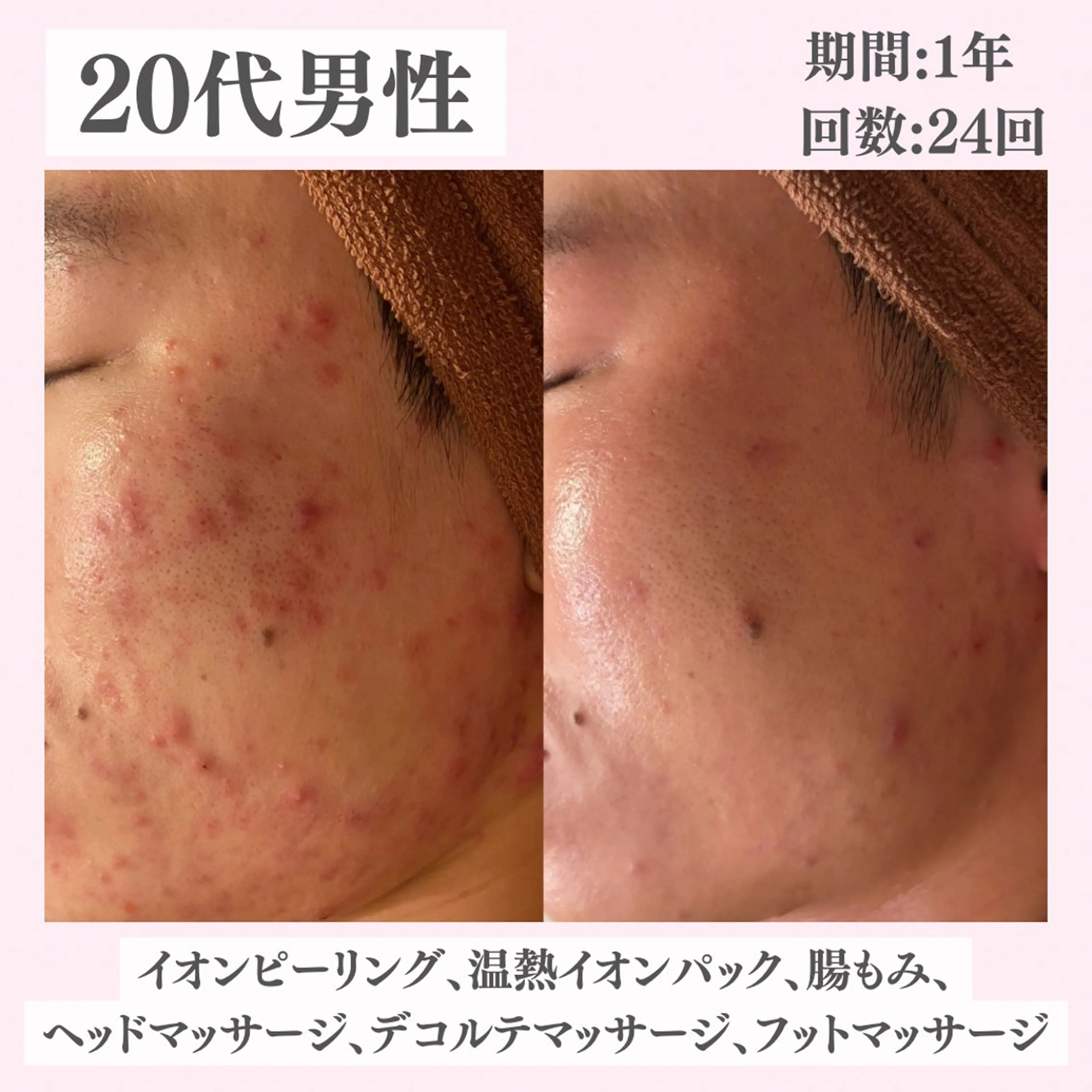 エステ リラク ニキビ・肌質改善専門 ♡人生が変わるサロンのエステ・リラクイメージ