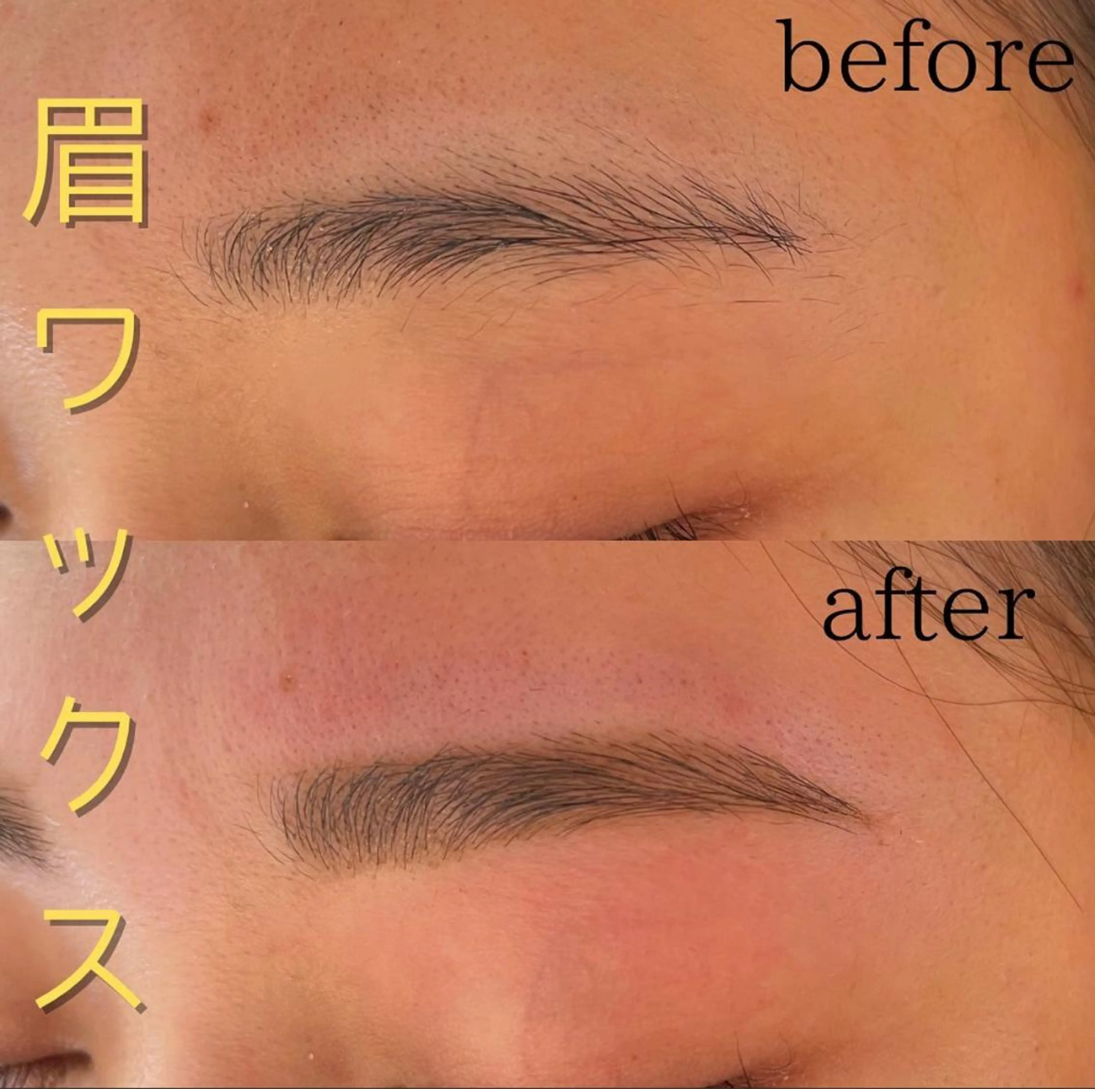 眉ワックス脱毛の写真