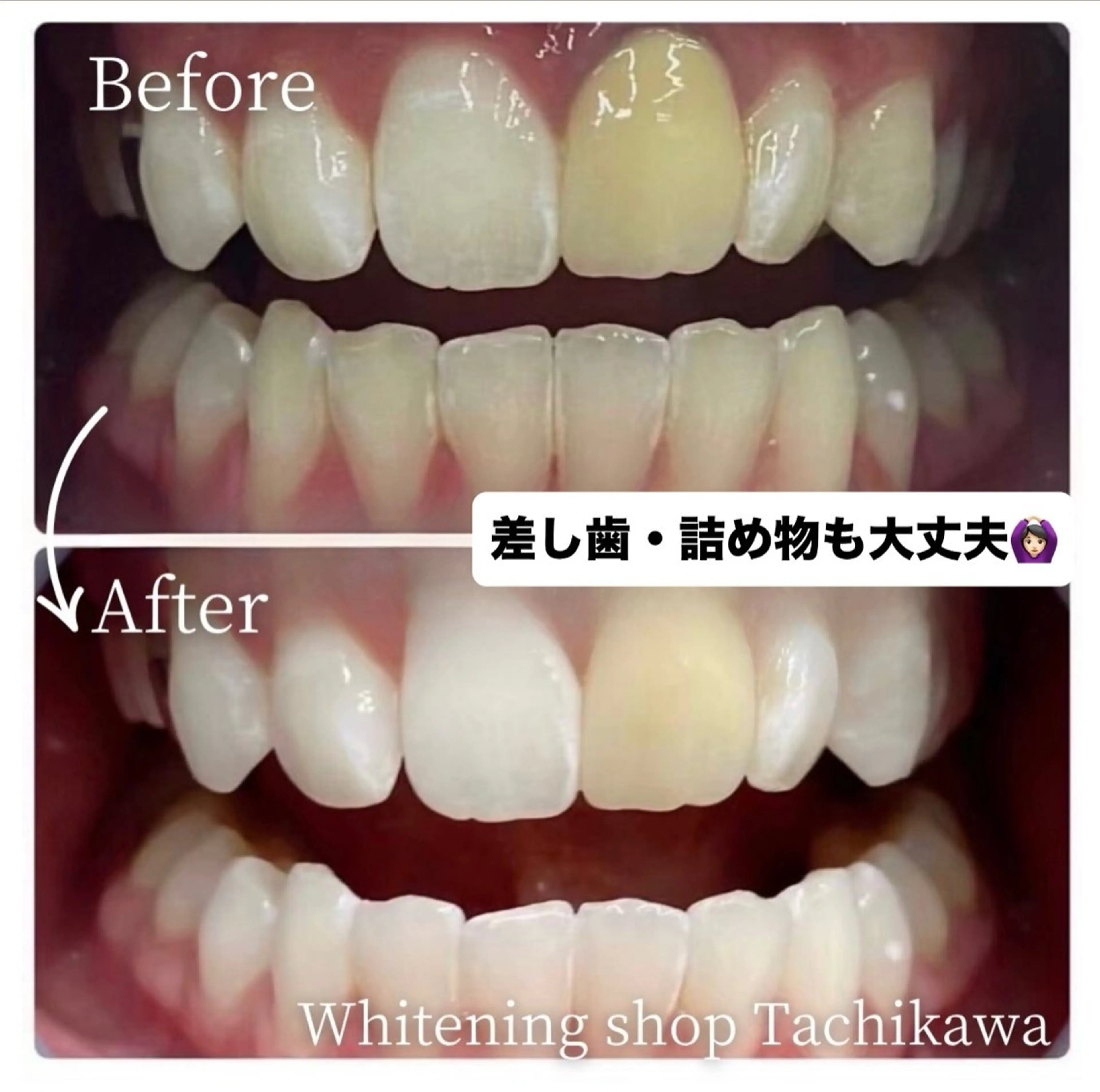 セルフ　ホワイト ニングショップ立川のその他イメージ